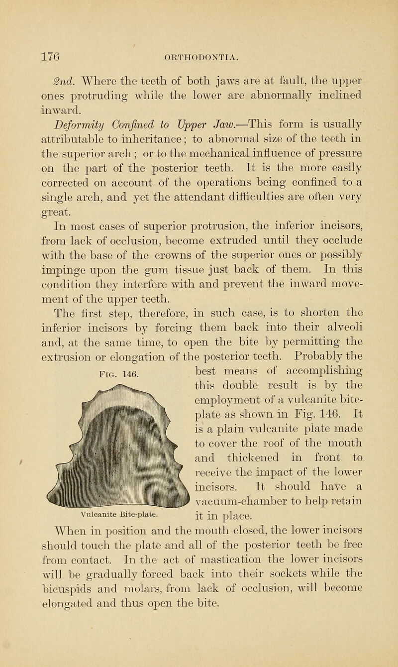 2nd. Where the teeth of both jaws are at fauh, the upper ones protruding while the lower are abnormally inclined inward. Deformity Confined to Upper Jaw.—This form is usually attributable to inheritance; to abnormal size of the teeth in the superior arch; or to the mechanical influence of pressure on the part of the posterior teeth. It is the more easily corrected on account of the operations being confined to a single arch, and yet the attendant difficulties are often very great. In most cases of superior protrusion, the inferior incisors, from lack of occlusion, become extruded until they occlude with the base of the crowns of the superior ones or possibly impinge upon the gum tissue just back of them. In this condition they interfere with and prevent the inward move- ment of the upi^er teeth. The first step, therefore, in such case, is to shorten the inferior incisors by forcing them back into their alveoli and, at the same time, to open the bite by permitting the extrusion or elongation of the posterior teeth. Probably the Pj(._ 146 best means of accomplishing this double result is by the employment of a vulcanite bite- plate as shown in Fig. 146. It is a plain vulcanite plate made to cover the roof of the mouth and thickened in front to. receive the impact of the lower incisors. It should have a >* Mm__Jg^^ vacuum-chamber to help retain Vtilcanite Bite-plate. ^^ i^l ])lace. When in position and the mouth closed, the lower incisors should touch the plate and all of the posterior teeth be free from contact. In the act of mastication the lower incisors will be gradually forced back into their sockets while the bicuspids and molars, from lack of occlusion, will become elongated and thus open the bite.