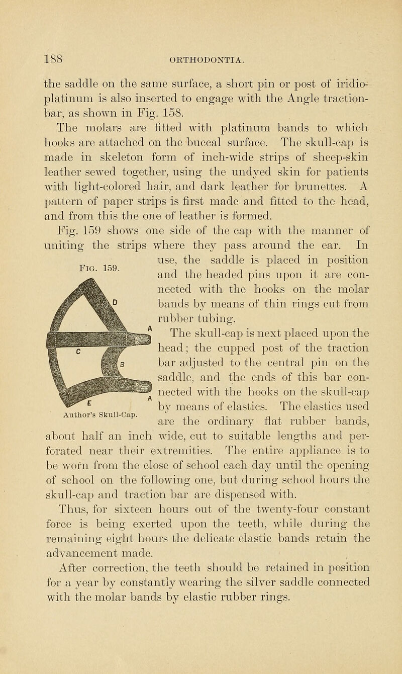 Fig. 159. the saddle on the same surface, a short pin or post of iridio- platinum is also inserted to engage with the Angle traction- bar, as shown in Fig. 158. The molars are fitted with platinum bands to which hooks are attached on the buccal surface. The skull-cap is made in skeleton form of inch-wide strijDs of sheep-skin leather sewed together, using the undyed skin for patients with light-colored hair, and dark leather for brunettes. A pattern of paper strips is first made and fitted to the head, and from this the one of leather is formed. Fig. 159 shows one side of the cap with the manner of uniting the strips where they pass around the ear. In use, the saddle is placed in position and the headed pins upon it are con- nected with the hooks on the molar bands by means of thin rings cut from rubber tubing. The skull-cap is next placed upon the head; the cupped post of the traction bar adjusted to the central pin on the saddle, and the ends of this bar con- nected with the hooks on the skull-cap by means of elastics. The elastics used are the ordinary flat rubber bands, about half an inch wide, cut to suitable lengths and per- forated near their extremities. The entire appliance is to be worn from the close of school each day until the opening of school on the following one, but during school hours the skull-cap and traction bar are dispensed with. Thus, for sixteen hours out of the twenty-four constant force is being exerted upon the teeth, while during the remaining eight hours the delicate elastic bands retain the advancement made. After correction, the teeth should be retained in position for a year by constantly wearing the silver saddle connected with the molar bands by elastic rubber rings. Author's Skull-Cap.