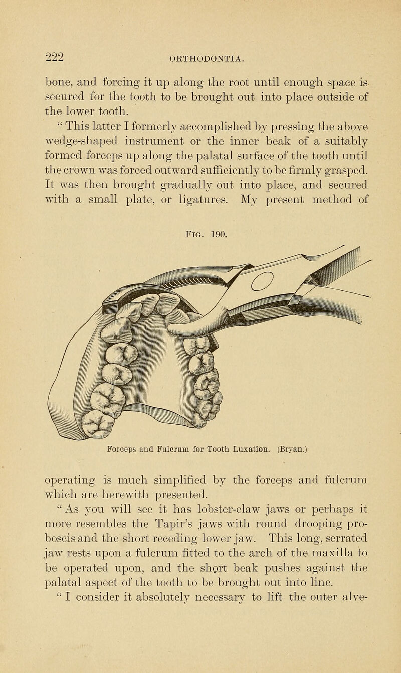 bone, and forcing it up along the root until enough space is secured for the tooth to be brought out into place outside of the lower tooth.  This latter I formerly accomplished by pressing the above wedge-shaped instrument or the inner beak of a suitably formed forceps up along the palatal surface of the tooth until the crown was forced outward sufficiently to be firmly grasped. It was then brought gradually out into place, and secured with a small plate, or ligatures. My present method of Fig. 190. Forceps and Fulcrum for Tooth Luxation. (Bryan.) operating is much simplified by the forceps and fulcrum which are herewith presented. As you will see it has lobster-claw jaws or perhaps it more resembles the Tapir's jaws with round drooping pro- boscis and the short receding lower jaw. This long, serrated jaw rests upon a fulcrum fitted to the arch of the maxilla to be operated upon, and the short beak pushes against the palatal aspect of the tooth to be brought out into line.  I consider it absolutely necessary to lift the outer alve-