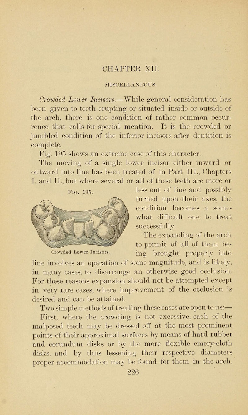 MISCELLANEOUS. Crowded Lower Incisors.—While general consideration has been given to teeth erupting or situated inside or outside of the arch, there is one condition of rather common occur- rence that calls for special mention. It is the crowded or jumbled condition of the inferior incisors after dentition is complete. Fig. 195 shows an extreme case of this character. The moving of a single lower incisor either inward or outward into line has been treated of in Part III., Chapters I. and II., but where several or all of these teeth are more or Fig. 195. ^^^^ *^^^ *^f li^® ^^^^ possibly turned upon their axes, the condition becomes a some- what difficult one to treat successfully. The expanding of the arch to permit of all of them be- Crowded Lower Incisors. [-^g brOUght prOpcrly iutO line involves an operation of some magnitude, and is likely, in many cases, to disarrange an otherwise good occlusion. For these reasons expansion should not be attempted except in very rare cases, where improvement of the occlusion is desired and can be attained. Two simple methods of treating these cases are open to us:— First, where the crowding is not excessive, each of the malposed teeth may be dressed off at the most prominent points of their approximal surfaces by means of hard rubber and corundum disks or by the more flexible emery-cloth disks, and by thus lessening their respective diameters proper accommodation may be found for them in the arch.