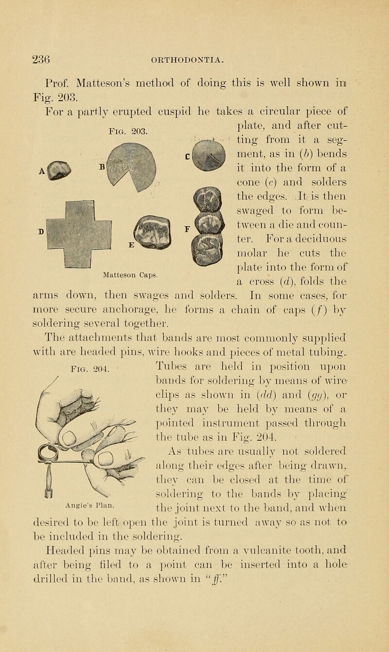 Fig. 203. Matteson Caps. Prof. Matteson's method of doing this is well shown in Fig. 203. For a partly erupted cuspid he takes a circular piece of plate, and after cut- ting from it a seg- ment, as in (b) bends it into the form of a cone (c) and solders- the edges. It is then swaged to form be- tween a die and coun- ter. For a deciduous molar he cuts the plate into the form of a cross (d), folds the arms down, then swages and solders. In some cases, for more secure anchorage, he forms a chain of caps (/) by soldering several together. The attachments that bands are most commonly supplied with are headed pins, wire hooks and pieces of metal tubing. Tubes are held in position upon bands for soldering by means of wire- clips as shown in (dd) and [gy), or they ma}'' be held by means of a pointed instrument passed through the tube as in Fig. 204. As tubes are usually not soldered along their edges after being drawn, the} can be closed at the time of soldering to the bands by placing the joint next to the band, and when desired to be left open the joint is turned away so as not to be included in the soldering. Headed pins may be obtained from a vulcanite tooth, and after being filed to a point can be inserted into a hole Fig. 204. Angle's Plan. drilled in the band, as shown in J.