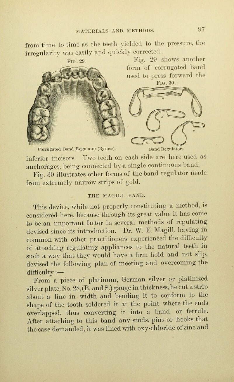 from time to time as the teeth yielded to the pressure, the irregularity was easily and quickly corrected. YiG. 29. Fig- 29 shows another form of corrugated band used to press forward the Fig. 30. Corrugated Band Regulator (Byrnes). Band Regulators. inferior incisors. Two teeth on each side are here used as anchorages, being connected by a single continuous band. Fig. 30 illustrates other forms of the band regulator made from extremely narrow strips of gold. THE MAGILL BAND. This device, while not properly constituting a method, is considered here, because through its great value it has come to be an important factor in several methods of regulating devised since its introduction. Dr. W. E. Magill, having in common with other practitioners experienced the difficulty of attaching regulating appliances to the natural teeth in such a way that they would have a firm hold and not slip, devised the following plan of meeting and overcoming the difficulty:— From a piece of platinum, German silver or platinized silver plate. No. 28, (B. and S.) gauge in thickness, he cut a strip about a line in width and bending it to conform to the shape of the tooth soldered it at the point where the ends overlapped, thus converting it into a band or ferrule. After attaching to this band any studs, pins or hooks that the case demanded, it was lined with oxy-chloride of zinc and