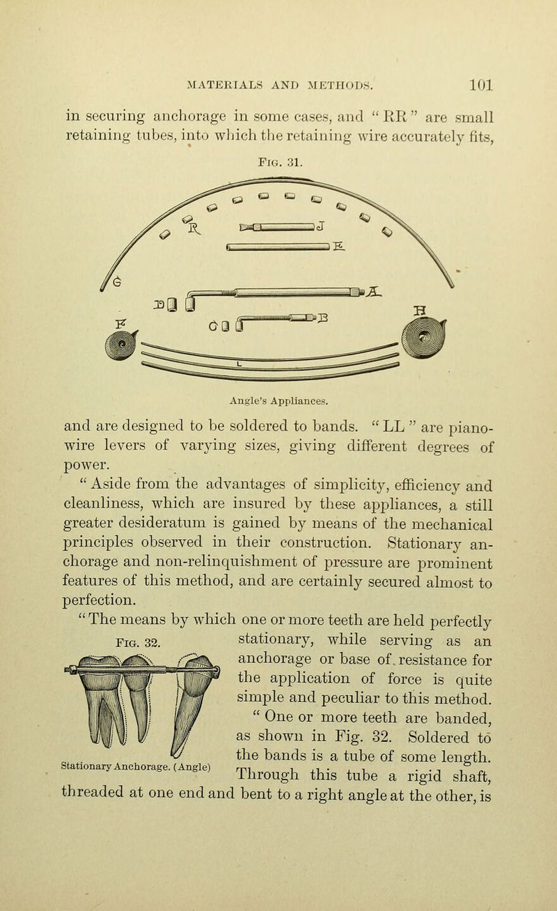 in securing anchorage in some cases, and  RR  are small retaining tubes, into which the retaining wire accurately fits, Fig. 31. Angle's Appliances. and are designed to be soldered to bands.  LL  are piano- wire levers of varying sizes, giving different degrees of power.  Aside from the advantages of simiDlicity, efficiency and cleanliness, which are insured by these ai3j)liances, a still greater desideratum is gained by means of the mechanical principles observed in their construction. Stationary an- chorage and non-relinquishment of pressure are prominent features of this method, and are certainly secured almost to perfection,  The means by which one or more teeth are held perfectly stationary, while serving as an anchorage or base of, resistance for the application of force is quite simple and peculiar to this method.  One or more teeth are banded, as shown in Fig. 32. Soldered to the bands is a tube of some length. stationary Anchorage. (Angle) rni i ji • , i ••-,■,„ Through this tube a rigid shaft, threaded at one end and bent to a right angle at the other, is Fig. 32.