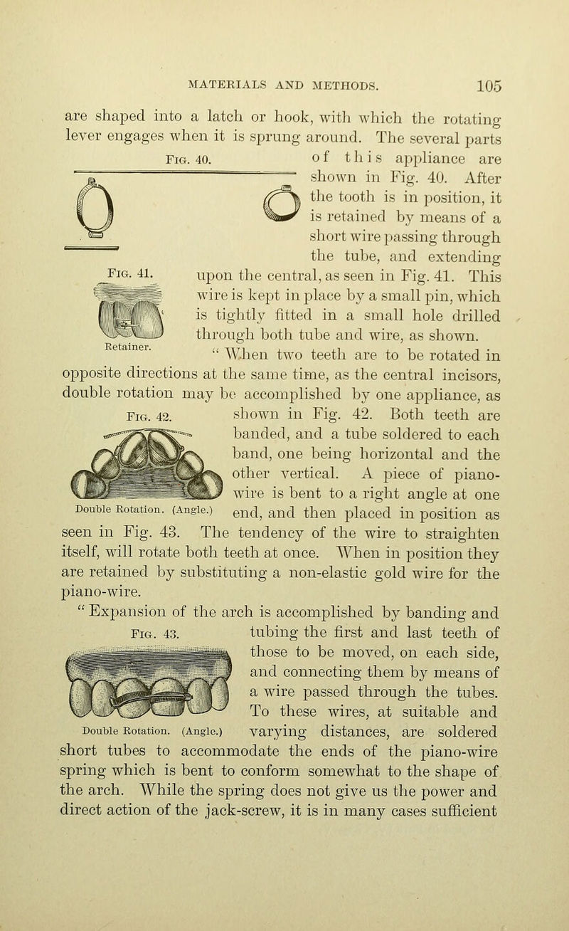 Retainer. are shaped into a latch or hook, with which the rotating lever engages when it is sprung around. The several parts Fig. 40. o f t h i s appliance are shown in Fig. 40. After the tooth is in position, it is retained by means of a short wire passing through the tube, and extending ^iG. 41. upon the central, as seen in Fig. 41. This wire is kept in place by a small pin, which is tightly fitted in a small hole drilled through both tube and wire, as shown.  W,hen two teeth are to be rotated in opposite directions at the same time, as the central incisors, double rotation may bo accomplished by one appliance, as Fig. 42. shown in Fig. 42. Both teeth are banded, and a tube soldered to each band, one being horizontal and the other vertical. A piece of piano- wire is bent to a right angle at one Double Rotation. (Angle.) ^ud, and then placed in position as seen in Fig. 43. The tendency of the wire to straighten itself, will rotate both teeth at once. When in position they are retained by substituting a non-elastic gold wire for the piano-wire.  Expansion of the arch is accomplished by banding and Fig. 43. tubing the first and last teeth of those to be moved, on each side, and connecting them by means of a wire passed through the tubes. To these wires, at suitable and Double Rotation. (Angle.) Varying distanccs, are soldered short tubes to accommodate the ends of the piano-wire spring which is bent to conform somewhat to the shape of the arch. While the spring does not give us the power and direct action of the jack-screw, it is in many cases sufficient