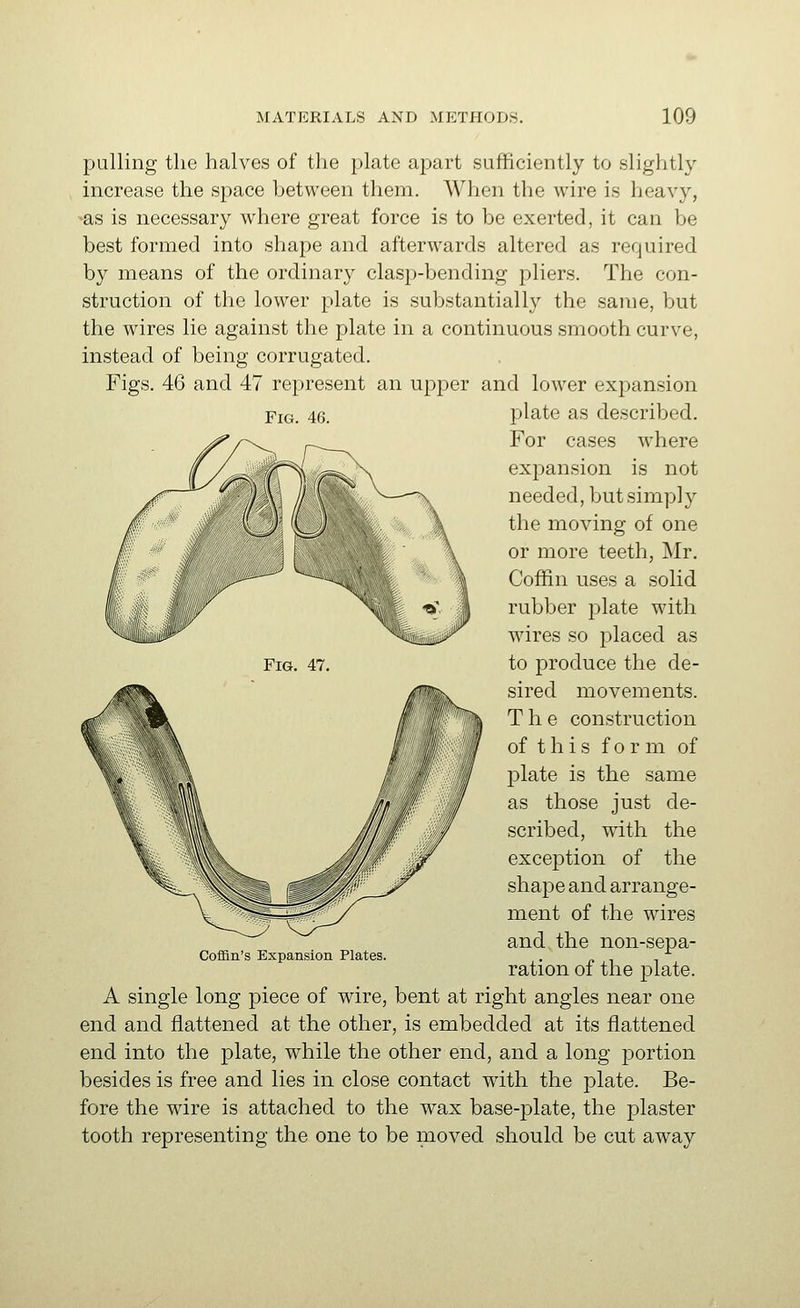 Fig. 46. pulling the halves of the plate apart sufficiently to slightly increase the space between them. When the wire is heavy, -as is necessary where great force is to be exerted, it can be best formed into shape and afterwards altered as required by means of the ordinary clasp-bending pliers. The con- struction of the lower plate is substantially the same, but the wires lie against the plate in a continuous smooth curve, instead of being corrugated. Figs. 46 and 47 represent an upper and lower expansion plate as described. For cases where expansion is not needed, but simply the moving of one or more teeth, Mr. Coffin uses a solid rubber plate with wires so placed as to produce the de- sired movements. The construction of this for m of plate is the same as those just de- scribed, with the exception of the shape and arrange- ment of the wires and the non-sepa- ration of the plate. A single long piece of wire, bent at right angles near one end and flattened at the other, is embedded at its flattened end into the plate, while the other end, and a long portion besides is free and lies in close contact wdth the plate. Be- fore the wire is attached to the wax base-plate, the plaster tooth representing the one to be moved should be cut away Coffin's Expansion Plates.