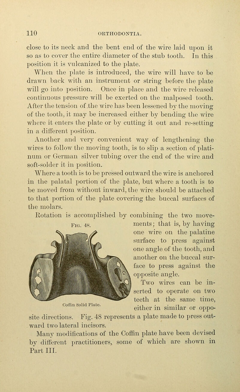 close to its neck and the bent end of the wire laid upon it so as to cover the entire diameter of the stub tooth. In this position it is vulcanized to the plate. When the plate is introduced, the wire will have to be drawn back with an instrument or string before the plate will go into position. Once in place and the wire released continuous pressure will be exerted on the mal|)osed tooth. After the tension of .the wire has been lessened by the moving of the tooth, it may be increased either by bending the wire where it enters the plate or by cutting it out and re-setting in a different position. Another and very convenient way of lengthening the wires to follow the moving tooth, is to slip a section of plati- num or German silver tubing over the end of the wire and soft-solder it in position. Where a tooth is to be pressed outward the wire is anchored in the palatal jDortion of the plate, but where a tooth is to be moved from without inward, the wire should be attached to that portion of the plate covering the buccal surfaces of the molars. Rotation is accomplished by combining the two move- ments ; that is, by having one wire on the palatine surface to press against one angle of the tooth, and another on the buccal sur- face to press against the opposite angle. Two wires can be in- serted to operate on two teeth at the same time, either in similar or oppo- site directions. Fig. 48 represents a plate made to press out- ward two lateral incisors. Many modifications of the Coffin plate have been devised by different practitioners, some of which are shown in Part III. Fig. 48. Coffin Solid Plate.