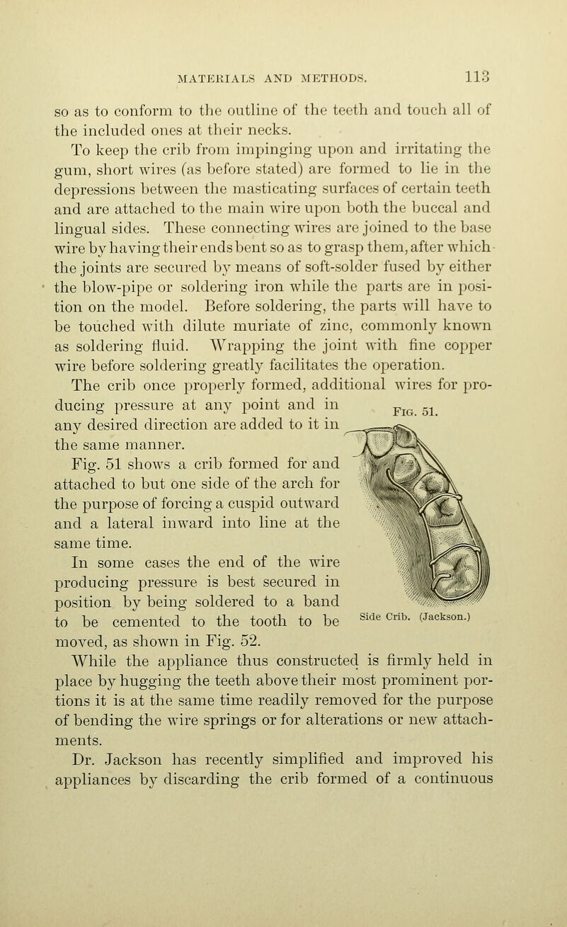 Fig. 51. SO as to conform to the outline of the teeth and touch all of the included ones at their necks. To keep the crib from impinging upon and irritating the gum, short wires (as before stated) are formed to lie in the depressions between the masticating surfaces of certain teeth and are attached to the main wire upon both the buccal and lingual sides. These connecting wires are joined to the base wire by having their ends bent so as to grasp them, after which the joints are secured by means of soft-solder fused by either the blow-pipe or soldering iron while the parts are in posi- tion on the model. Before soldering, the parts will have to be touched with dilute muriate of zinc, commonly known as soldering fluid. AVrapping the joint with fine copper wire before soldering greatl}^ facilitates the operation. The crib once properly formed, additional wires for pro- ducing pressure at any point and in any desired direction are added to it in the same manner. Fig. 51 shows a crib formed for and attached to but one side of the arch for the purpose of forcing a cuspid outward and a lateral inward into line at the same time. In some cases the end of the wire producing pressure is best secured in position by being soldered to a band to be cemented to the tooth to be moved, as shown in Fig. 52. While the appliance thus constructed is firmly held in place by hugging the teeth above their most prominent por- tions it is at the same time readily removed for the purpose of bending the wire springs or for alterations or new attach- ments. Dr. Jackson has recently simplified and improved his appliances by discarding the crib formed of a continuous