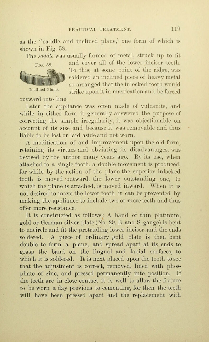as the  saddle and inclined j^lane, one form of which is shown in Fig. 58. The saddle was usually formed of metal, struck up to fit jpj^ 53 and cover all of the lower incisor teeth. To this, at some point of the ridge, was M>ldered an inclined piece of heavy metal -'.J arranged that the inlocked tooth would strike upon it in mastication and be forced outward into line. Later the appliance was often made of vulcanite, and while in either form it generally answered the purpose of correcting the simple irregularity, it was objectionable on account of its size and because it was removable and thus liable to be lost or laid aside and not worn. A modification of and improvement upon the old form, retaining its virtues and obviating its disadvantages, was devised by the author many years ago. By its use, when attached to a single tooth, a double movement is produced, for while by the action of the plane the superior inlocked tooth is moved -outward, the lower outstanding one, to which the plane is attached, is moved inward. When it is not desired to move the lower tooth it can be prevented by making the appliance to include two or more teeth and thus offer more resistance. It is constructed as follows: A band of thin platinum, gold or German silver plate (No. 29, B. and S. gauge) is bent to encircle and fit the protruding lower incisor, and the ends soldered. , A 23iece of ordinary gold plate is then bent double to form a plane, and spread apart at its ends to grasp the band on the lingual and labial surfaces, to which it is soldered. It is next placed upon the tooth to see that the adjustment is correct, removed, lined with phos- phate of zinc, and pressed permanently into position. If the teeth are in close contact it is well to allow the fixture to be worn a day previous to cementing, for then the teeth will have been pressed apart and the replacement with