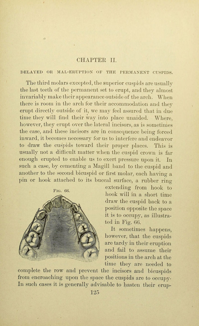 DELAYED OR MAL-ERUPTION OF THE PERMANENT CUSPIDS. The third molars excepted, the superior cuspids are usually the last teeth of the permanent set to erupt, and they almost invariably make their appearance outside of the arch. AVhen there is room in the arch for their accommodation and they erupt directly outside of it, we may feel assured that in due time they will find their way into place unaided. Where, however, they erupt over the lateral incisors, as is sometinies the case, and these incisors are in consequence Ijeing forced inward, it becomes necessary for us to interfere and endeavor to draw the cuspids toward their pro|)er places. This is usually not a difficult matter when the cuspid crown is far enough erupted to enable us to exert pressure upon it. In such a case, by cementing a Magill band to the cuspid and another to the second bicuspid or first molar, each having a pin or hook attached to its buccal surface, a rubber rino- p^ extending from hook to hook will in a short time draw the cuspid back to a position opposite the space it is to occupy, as illustra- ted in Fig. 66. It sometimes happens, however, that the cuspids are tardy in their eruption and fail to assume their positions in the arch at the time they are needed to complete the row and prevent the incisors and bicuspids from encroaching upon the space the cuspids are to occupy- In such cases it is generally advisable to hasten their erup-