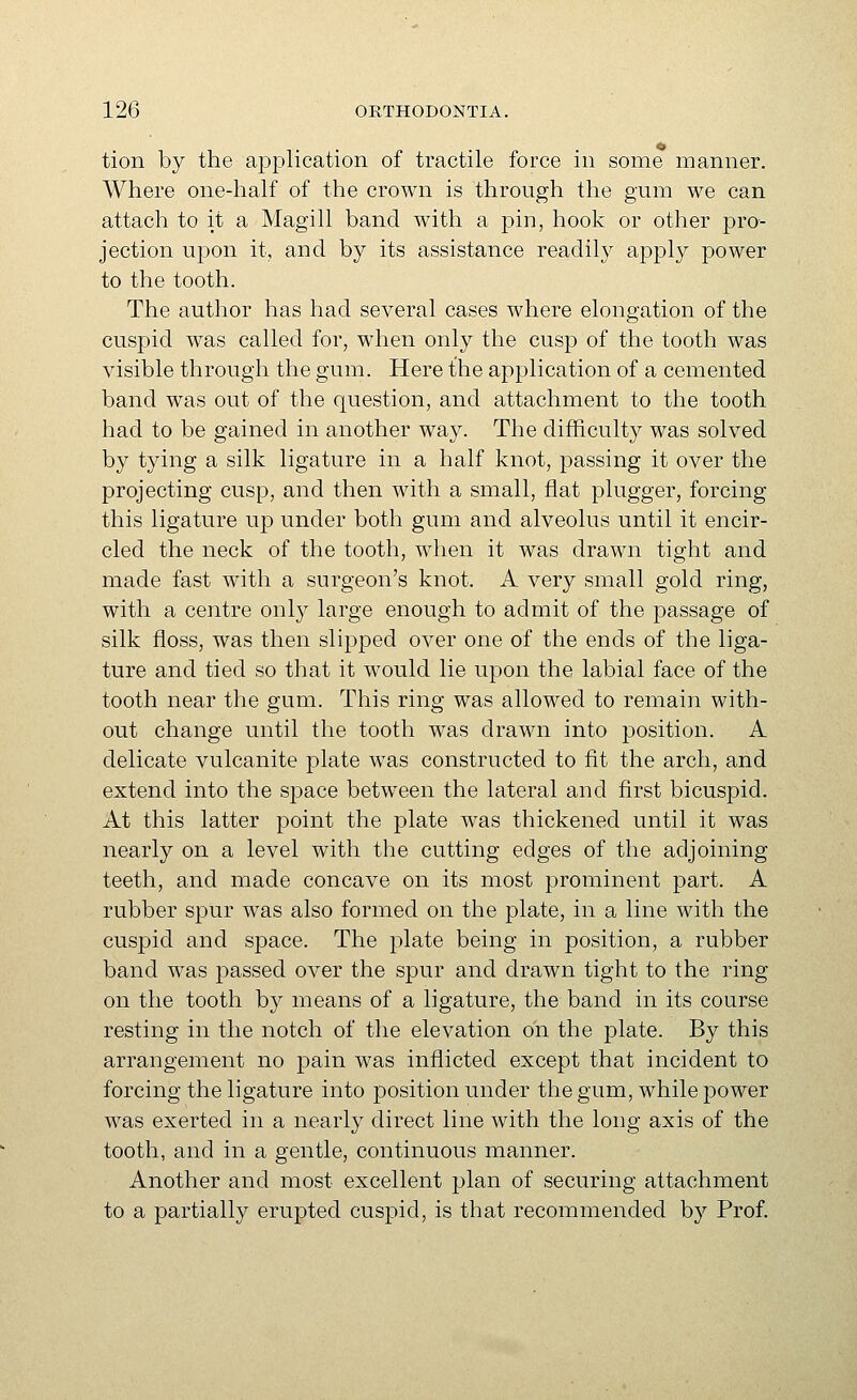 tion by the application of tractile force in some manner. Where one-half of the crown is through the gum we can attach to it a Magi 11 band with a pin, hook or other pro- jection upon it, and by its assistance readily appl}^ power to the tooth. The author has had several cases where elongation of the cuspid was called for, wdien only the cusp of the tooth was visible through the gum. Here the application of a cemented band was out of the question, and attachment to the tooth had to be gained in another way. The difficulty was solved by tying a silk ligature in a half knot, passing it over the projecting cusp, and then with a small, flat plugger, forcing this ligature up under both gum and alveolus until it encir- cled the neck of the tooth, when it was drawn tight and made fast with a surgeon's knot. A very small gold ring, with a centre only large enough to admit of the passage of silk floss, was then slipped over one of the ends of the liga- ture and tied so that it would lie upon the labial face of the tooth near the gum. This ring was allowed to remain with- out change until the tooth was drawn into position. A delicate vulcanite plate was constructed to fit the arch, and extend into the space between the lateral and first bicuspid. At this latter point the plate was thickened until it was nearly on a level with the cutting edges of the adjoining teeth, and made concave on its most prominent part. A rubber spur was also formed on the plate, in a line with the cuspid and space. The plate being in position, a rubber band was passed over the spur and drawn tight to the ring on the tooth by means of a ligature, the band in its course resting in the notch of the elevation on the plate. By this arrangement no pain was inflicted except that incident to forcing the ligature into j)Osition under the gum, while power was exerted in a nearly direct line with the long axis of the tooth, and in a gentle, continuous manner. Another and most excellent plan of securing attachment to a partially erupted cuspid, is that recommended by Prof.