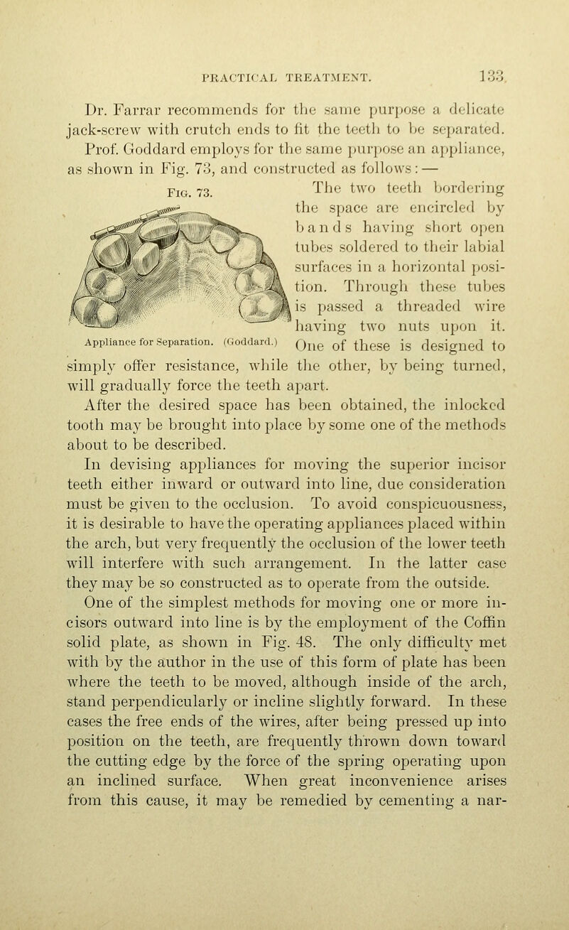 Dr. Farrar recommends for the same purpose a delicate jack-screw with crutcli ends to fit the teeth to he separated. Prof. Goddard employs for the same purpose an appliance, as shown in Fig. 73, and constructed as follows: — The two teeth bordering the space are encircled by bands having short open tubes soldered to their labial surfaces in a horizontal posi- tion. Through these tubes k\ is passed a threaded wire having two nuts upon it. Appliance for Separation. (Goddard.) Q^^^ ^f ^j^gg^ jg designed tO simply offer resistance, while the other, by being turned, will gradually force the teeth apart. After the desired space has been obtained, the inlockcd tooth may be brought into pjlace by some one of the methods about to be described. In devising appliances for moving the superior incisor teeth either inward or outward into line, due consideration must be given to the occlusion. To avoid conspicuousness, it is desirable to have the operating appliances placed within the arch, but very frequently the occlusion of the lower teeth will interfere with such arrangement. In the latter case they may be so constructed as to operate from the outside. One of the simplest methods for moving one or more in- cisors outward into line is by the employment of the Coffin solid plate, as shown in Fig. 48. The only difficulty met with by the author in the use of this form of plate has been where the teeth to be moved, although inside of the arch, stand perpendicularly or incline slightly forward. In these cases the free ends of the wires, after being pressed up into position on the teeth, are frequently thrown down toward the cutting edge by the force of the spring operating upon an inclined surface. When great inconvenience arises from this cause, it may be remedied by cementing a nar-