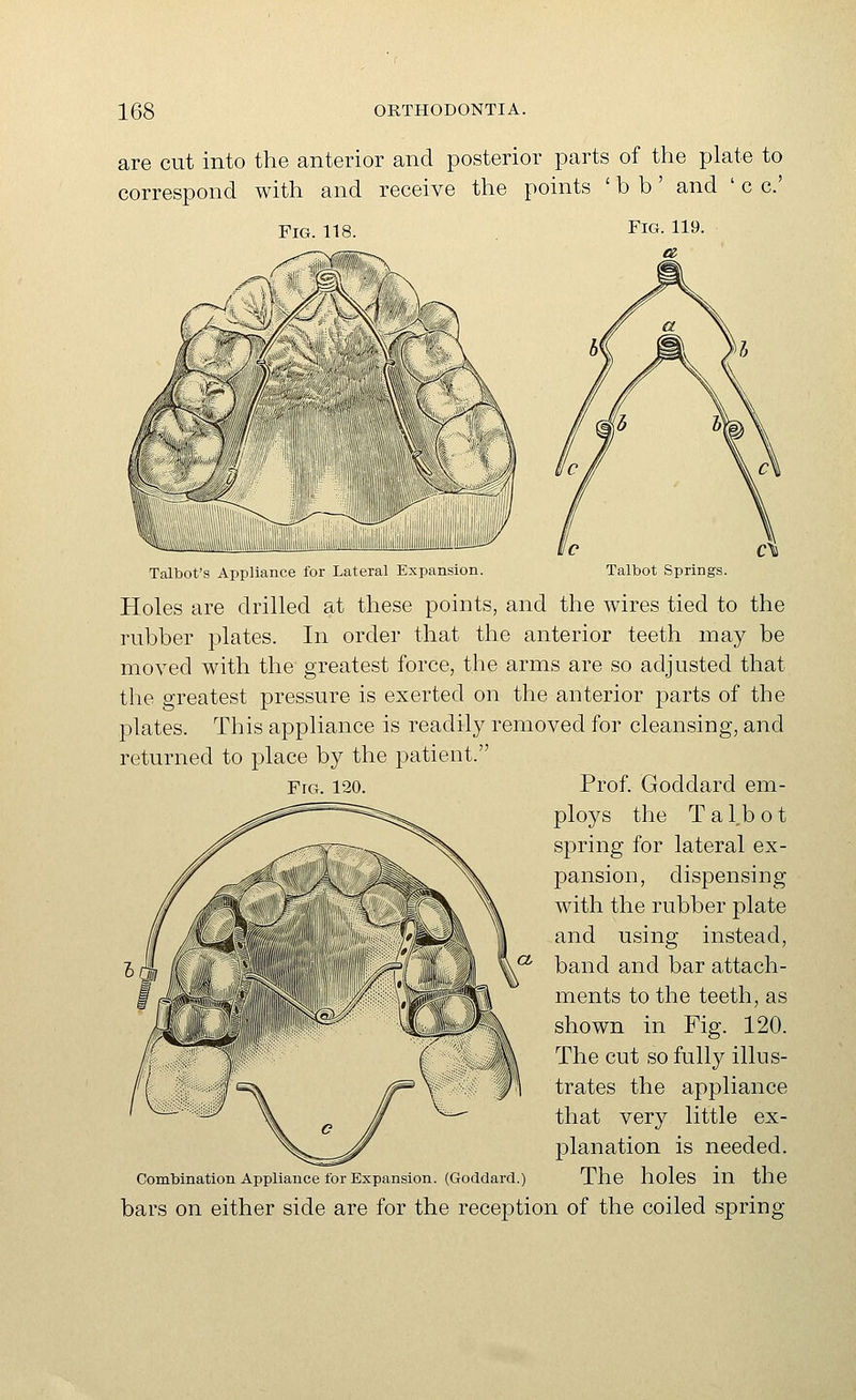 are cut into the anterior and posterior parts of the plate to correspond with and receive the points ' b b' and ' c c' Talbot's Appliance for Lateral Expansion. Talbot Springs. Holes are drilled at these points, and the wires tied to the rubber plates. In order that the anterior teeth may be moved with the greatest force, the arms are so adjusted that the greatest pressure is exerted on the anterior parts of the plates. This appliance is readily removed for cleansing, and returned to place by the patient. Fig. 120. Prof. Goddard em- ploys the T a l,b o t spring for lateral ex- pansion, dispensing with the rubber plate and using instead, band and bar attach- ments to the teeth, as shown in Fig. 120. The cut so fully illus- trates the appliance that very little ex- planation is needed. Combination Appliance for Expansion. (Goddard.) The holcS in the bars on either side are for the reception of the coiled spring