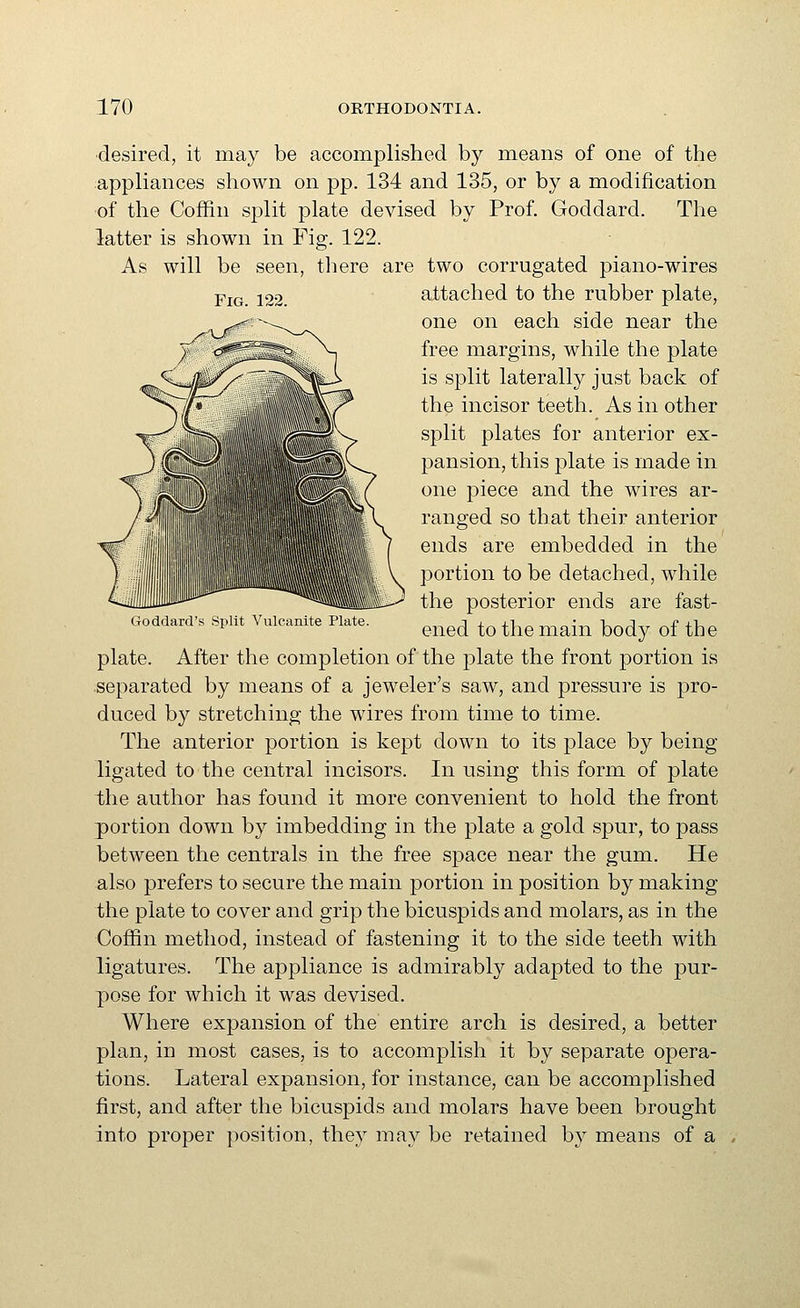 ■desired, it may be accomplished by means of one of the appliances shown on pp. 134 and 135, or by a modification ■of the Coffin split plate devised by Prof. Goddard. The latter is shown in Fig. 122. As will be seen, there are two corrugated piano-wires attached to the rubber plate, one on each side near the free margins, while the plate is split laterally just back of the incisor teeth. As in other split plates for anterior ex- pansion, this plate is made in one piece and the wires ar- ranged so that their anterior ends are embedded in the portion to be detached, while the posterior ends are fast- Goddard's split Vulcanite Plate. ^^^^^ ^^ ^j^^ ^^-^ ^^^^ ^^ ^^^ plate. After the completion of the plate the front portion is separated by means of a jeweler's saw, and pressure is pro- duced by stretching the wires from time to time. The anterior portion is kept down to its place by being ligated to the central incisors. In using this form of plate the author has found it more convenient to hold the front portion down by imbedding in the plate a gold spur, to pass between the centrals in the free space near the gum. He also prefers to secure the main portion in position by making the plate to cover and grip the bicuspids and molars, as in the Coffin method, instead of fastening it to the side teeth with ligatures. The appliance is admirably adapted to the pur- pose for which it was devised. Where expansion of the entire arch is desired, a better plan, in most cases, is to accomplish it by separate opera- tions. Lateral expansion, for instance, can be accomplished first, and after the bicuspids and molars have been brought into proper position, they may be retained by means of a