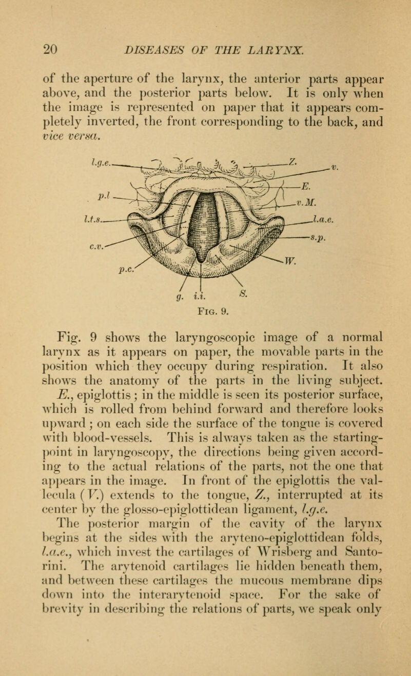 of the aperture of the larynx, the anterior parts appear above, and the posterior parts below. It is only when the image is represented on paper that it appears com- pletely inverted, the front corresponding to the back, and vice verna. U.s c.v. Fig. 9 shows the laryngoscopic image of a normal larynx as it appears on paper, the movable parts in the position which they occupy during respiration. It also shows the anatomy of the parts in the living subject. E., epiglottis ; in the middle is seen its posterior surface, which is rolled from behind forward and therefore looks uj)ward ; on each side the surface of the tongue is covered witli blood-vessels. This is always taken as tlie starting- ])()int in laryngoscopy, the directions being given accord- ing to the actual relations of the parts, not the one that apj)ears in the image. In front of the epiglottis the val- lecula (V.) extends to the tongue, Z., interrupted at its center by the glosso-e])iglottidean ligament, Lg.e. The posterior margin of the cavity of the larynx begins at the sides witli tlie aryteno-epiglottidean folds, Ld.c, wliich invest the cartilages of Wrisberg and Santo- rini. The arytenoid cartilages lie hidden beneath them, and between these cartilages tlie mucous membrane dips down into the interarytcnoid sj)ace. For the sake of brevity in describing the relations of parts, we speak only
