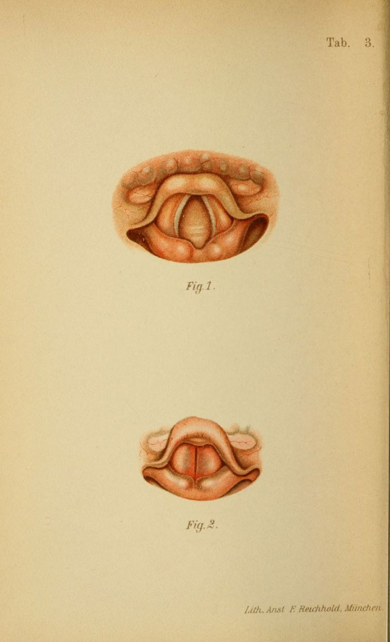 Fifil Fifj. ,v» 9 /Mh. Arusl E Heu'hhoUi, Miinchen.