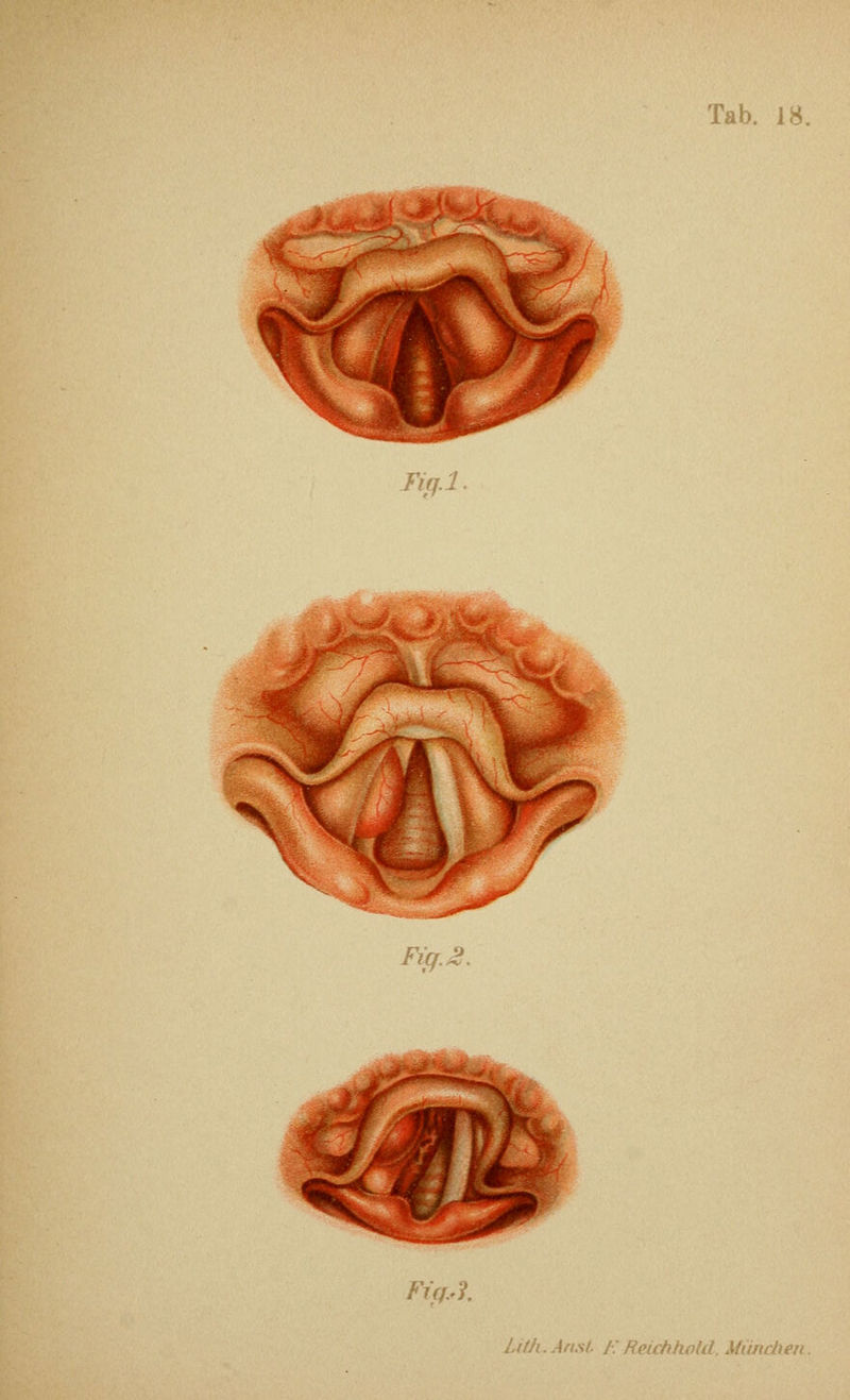 Fi(^.l Fig.Ji. tiff.'i. Uth.Anst F. Reidihold, Miindien.
