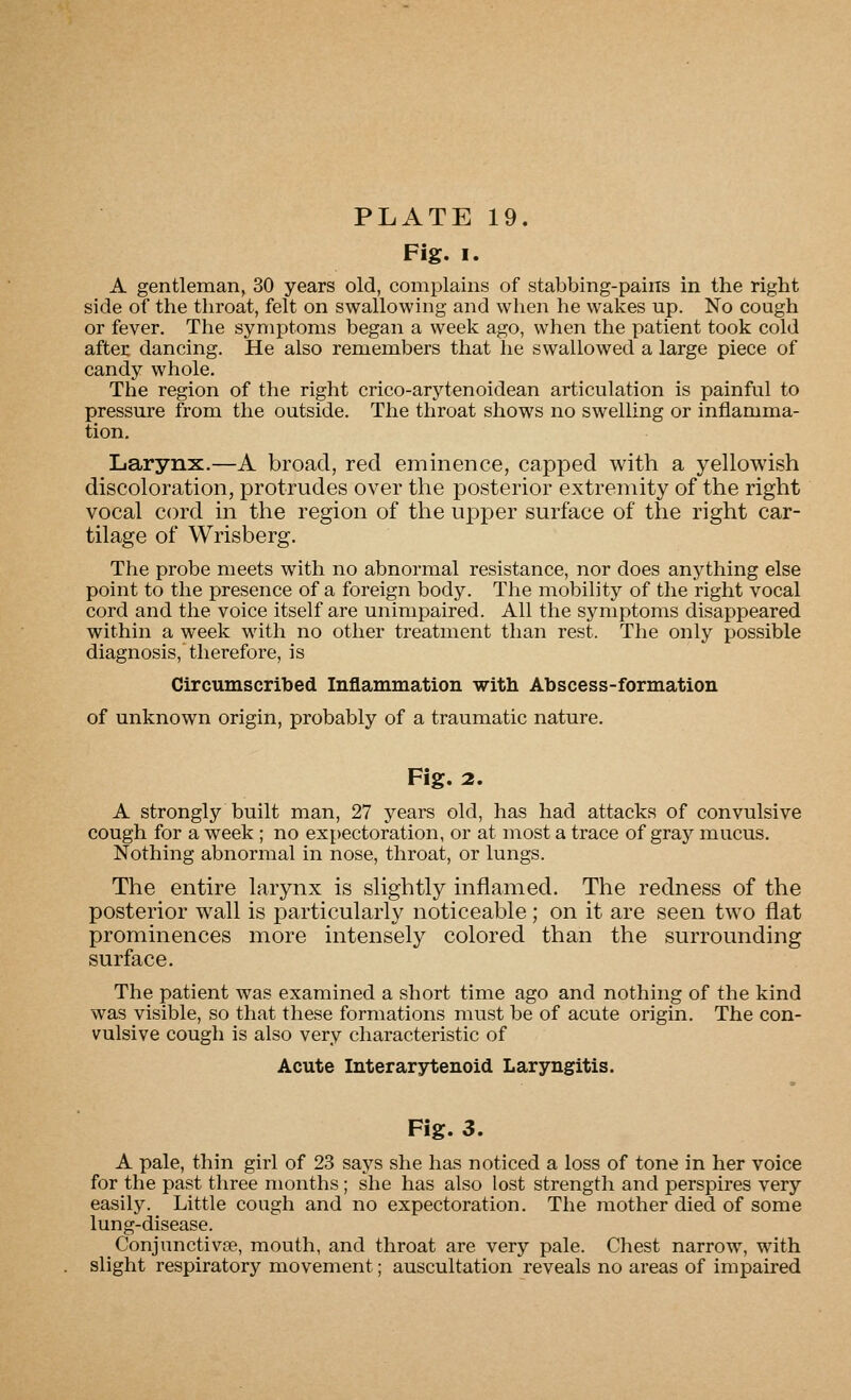 Fig. I. A gentleman, 30 years old, complains of stabbing-pains in the right side of the throat, felt on swallowing and when he wakes up. No cough or fever. The symptoms began a week ago, when the patient took cold after dancing. He also remembers that he swallowed a large piece of candy whole. The region of the right crico-arytenoidean articulation is painful to pressure from the outside. The throat shows no swelling or inflamma- tion. Larynx.—A broad, red eminence, capped with a yellowish discoloration, protrudes over the posterior extremity of the right vocal cord in the region of the upper surface of the right car- tilage of Wrisberg. The probe meets with no abnormal resistance, nor does anything else point to the presence of a foreign body. The mobility of the right vocal cord and the voice itself are unimpaired. All the symptoms disappeared within a week with no other treatment than rest. The only possible diagnosis, therefore, is Circumscribed Inflammation with Abscess-formation of unknown origin, probably of a traumatic nature. Fig. 2. A strongly built man, 27 years old, has had attacks of convulsive cough for a week ; no expectoration, or at most a trace of gray mucus. Nothing abnormal in nose, throat, or lungs. The entire larynx is slightly inflamed. The redness of the posterior wall is particularly noticeable; on it are seen two flat prominences more intensely colored than the surrounding surface. The patient was examined a short time ago and nothing of the kind was visible, so that these formations must be of acute origin. The con- vulsive cough is also very characteristic of Acute Interarytenoid Laryngitis. Fig. 3. A pale, thin girl of 23 says she has noticed a loss of tone in her voice for the past three months ; she has also lost strength and perspires very easily. Little cough and no expectoration. The mother died of some lung-disease. Conjunctivse, mouth, and throat are very pale. Chest narrow, with slight respiratory movement; auscultation reveals no areas of impaired