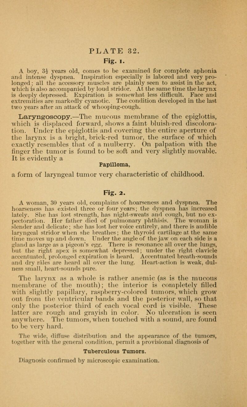 Fig. I. A boy, 3i years old, comes to be examined for complete aphonia and intense dyspnea. Inspiration especially is labored and very pro- longed ; all the accessory muscles are plainly seen to assist in the act, which is also accompanied bj^ loud stridor. At the same time the larynx is deeply depressed. Expiration is somewhat less difficult. Face and extremities are markedly cyanotic. The condition developed in the last two years after an attack of whooping-cough. Laryngoscopy.—The mucous membrane of the epiglottis, which is displaced forward, shows a faint bluish-red discolora- tion. Under the epiglottis and covering the entire aperture of the larynx is a bright, brick-red tumor, the surface of which exactly resembles that of a mulberry. On palpation with the finger the tumor is found to be soft and very slightly movable. It is evidently a Papilloma, a form of laryngeal tumor very characteristic of childhood. Fig. 2. A woman, 30 years old, complains of hoarseness and dyspnea. The hoarseness has existed three or four years; the dyspnea has increased lately. She has lost strength, has night-sweats and cough, but no ex- pectoration. Her fatlier died of pulmonary phthisis. The woman is slender and delicate; she has lost her voice entirely, and there is audible laryngeal stridor when she breathes; the thyroid cartilage at the same time moves up and down. Under the angle of the jaw on each side is a gland as large as a pigeon's egg. There is resonance all over the lungs, but the right apex is somewhat depressed; under the riglit clavi(.*le accentuated, prolonged expiration is heanl. Accentuated breath-sounds and dry rales are heard all over the lung. Heart-action is weak, dul- ness .small, heart-sounds pure. The larynx as a whole is rather anemic (as is the mucous membrane of the mouth); the interior is cornpk^tely filled with slightly pa[)illary, raspberry-colored tumors, which grow out from the ventri(ailar l)ands and the posterior wall, so that only the posterior third of each vocal cord is visible. These latter are rough and grayish in color. No iilceration is seen anywhere. The tumors, when touched with a sound, are found to be very hard. The wide, diffuse distribution and the appearance of the tumors, together with the general conditiijn, permit a provisional diagnosis of Tuberculous Tumors. Diagnosis confirmed by microscopic examination.