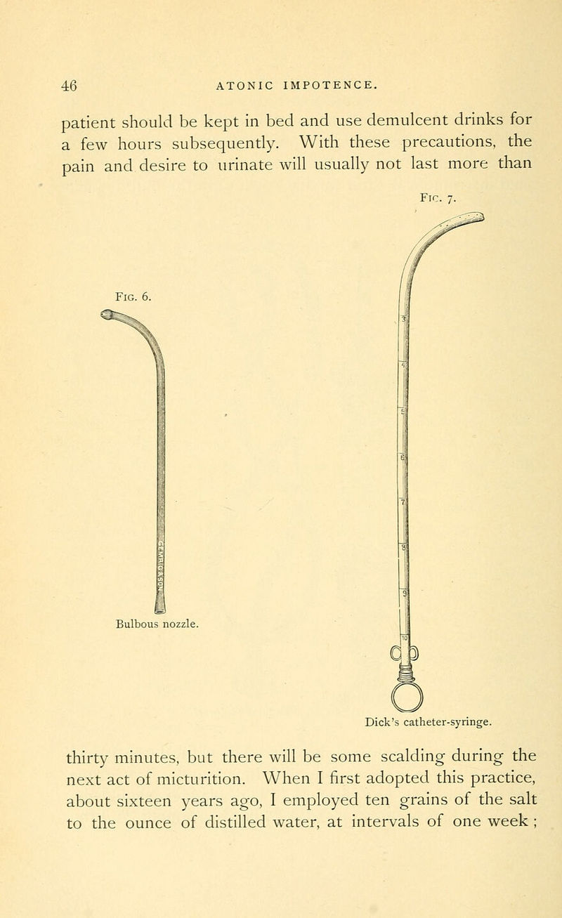 patient should be kept in bed and use demulcent drinks for a few hours subsequently. With these precautions, the pain and desire to urinate will usually not last more than Fic. 7. Fig. 6. Bulbous nozzle. Dick's catheter-syringe. thirty minutes, but there will be some scalding during the next act of micturition. When I first adopted this practice, about sixteen years ago, I employed ten grains of the salt to the ounce of distilled water, at intervals of one week ;