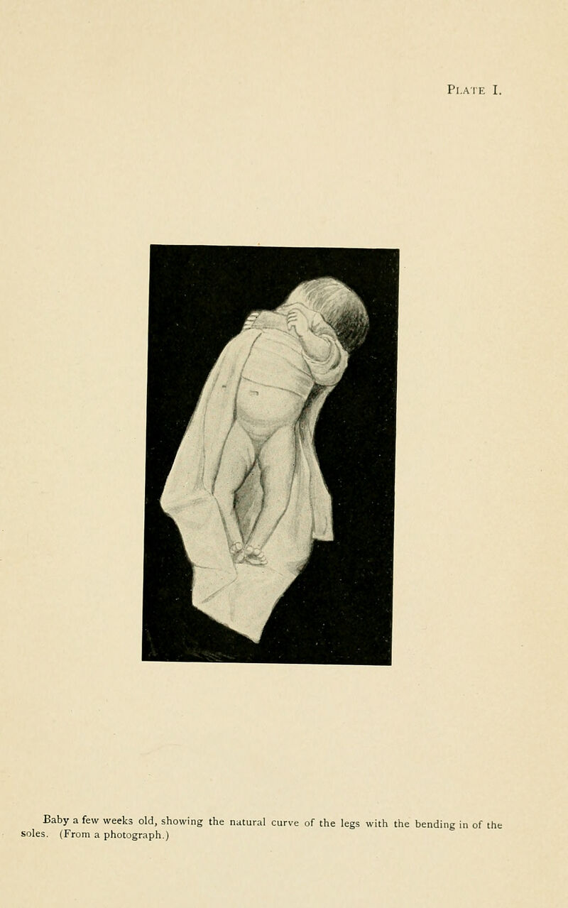 Plate I. Baby a few weeks old, showing the natural curve of the legs with the bending in of the