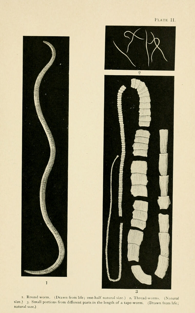 I. Roundworm. (Drawn from life ; one-half riHtural size.) 2, Thread-worms. (Naiural size.) 3. Small portions from different parts in the length of a tape-worm. (Drawn from life; natural size.)