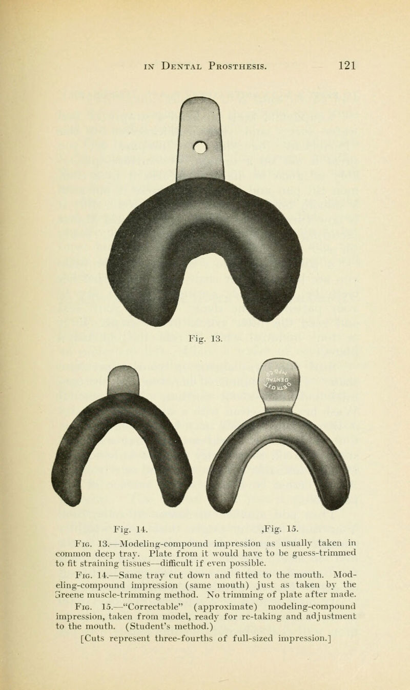 Fig. 13. Fig. 14. ,Fig. 15. Fig. 13.—Modeling-compound impression as usually taken in common deep tray. Plate from it would have to be guess-trimmed to fit straining tissues—difficult if even possible. Fig. 14.—Same tray cut down and fitted to the mouth. [Mod- eling-compound impression (same mouth) just as taken by the 3reene muscle-trimming method. No trimming of plate after made. Fig. 15.—Correctable (approximate) modeling-compound impression, taken from model, ready for re-taking and adjustment to the mouth. (Student's method.) [Cuts represent three-fourths of full-sized impression.]