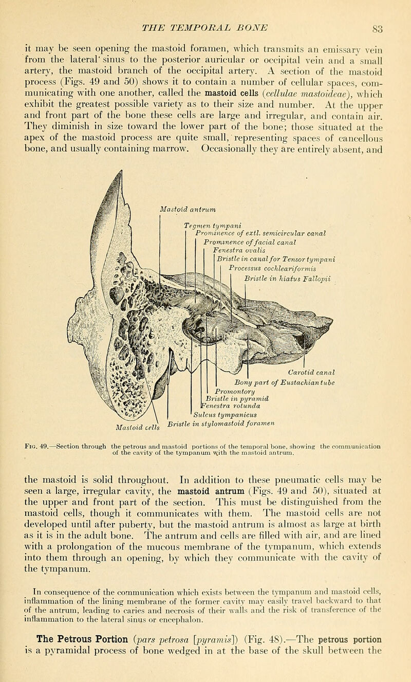 it may be seen opening the mastoid foramen, which transmits an emissary vein from the lateral' sinus to the posterior auricular or occipital vein and a small artery, the mastoid branch of the occipital artery. A section of the mastoid process (Figs. 49 and 50) shows it to contain a number of cellular spaces, com- municating with one another, called the mastoid cells (cellulae mastoideae), which exhibit the greatest possible variety as to their size and number. At the upper and front part of the bone these cells are large and irregular, and contain air. They diminish in size toward the lower part of the bone; those situated at the apex of the mastoid process are quite small, representing spaces of cancellous bone, and usually containing marrow. Occasionally they are entirely absent, and Mastoid antrum Tegmen tympani Prominence of extl. semicircular canal Prominence of facial canal Fenestra ovalis Bristle in canal for Tensor tympani Processus cocldeariformis Bnstle in hiaivs Fallopii Mastoid cells Carotid canal Bony pa} t of Eustachian tube Promontory Bristle in pyramid Fenestra rotunda Sulcus tympanicus Bristle in stylomastoid foramen. Fig. 49.—Section through the petrous and mastoid portions of the temporal bone, showing the communication of the cavity of the tympanum wiith the mastoid antrum. the mastoid is solid throughout. In addition to these pneumatic cells may be seen a large, irregular cavity, the mastoid antrum (Figs. 49 and 50), situated at the upper and front part of the section. This must be distinguished from the mastoid cells, though it communicates with them. The mastoid cells are not developed until after puberty, but the mastoid antrum is almost as large at birth as it is in the adult bone. The antrum and cells are filled with air, and are lined with a prolongation of the mucous membrane of the tympanum, which extends into them through an opening, by which they communicate with the cavity of the tympanum. In consequence of the communication which exists between the tympanum and mastoid cells, inflammation of the hning membrane of the former cavity may easily travel backward to that of the antrum, leading to caries and necrosis of their walls and the risk of transference of the inflammation to the lateral sinus or encephalon. The Petrous Portion {pars petrosa [pyramid]) (Fig. 48).—The petrous portion is a pyramidal process of bone wedged in at the base of the skull between the