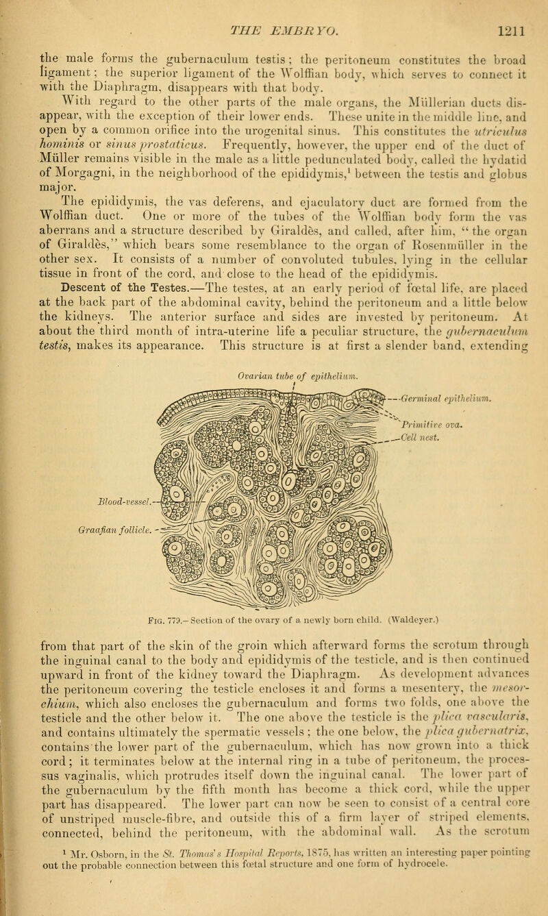 the male forms the gubernaculum testis; the peritoneum constitutes the broad ligament; the superior ligament of the Wolffian body, which serves to connect it with the Diaphragm, disappears with that body. With regard to the other parts of the male organs, the Miillerian ducts dis- appear, with the exception of their lower ends. These unite in the middle line, and open by a common orifice into the urogenital sinus. This constitutes the utriculus hominis or sinus prostatitis. Frequently, however, the upper end of the duct of Miiller remains visible in the male as a little pedunculated body, called the hydatid of Morgagni, in the neighborhood of the epididymis,1 between the testis and globus maj or. The epididymis, the vas deferens, and ejaculatory duct are formed from the Wolffian duct. One or more of the tubes of the Wolffian body form the vaa aberrans and a structure described by Giraldes, and called, after him. >k the organ of Giraldes, which bears some resemblance to the organ of Rosenmuller in the other sex. It consists of a number of convoluted tubules, lying in the cellular tissue in front of the cord, and close to the head of the epididymis. Descent of the Testes.—The testes, at an early period of foetal life, are placed at the back part of the abdominal cavity, behind the peritoneum and a little below the kidneys. The anterior surface and sides are invested by peritoneum. At about the third month of intra-uterine life a peculiar structure, the gubernacvlnin testis, makes its appearance. This structure is at first a slender band, extending Ovarian tube of epithelium. Blood-vessel. Graafian follicle. ■-Germinal epithelium. Primitive ova. -Cell nest. Fig. 779.—Section of the ovary of a, newly born child. iWaldeyer.) from that part of the skin of the groin which afterward forms the scrotum through the inguinal canal to the body and epididymis of the testicle, and is then continued upward in front of the kidney toward the Diaphragm. As development advances the peritoneum covering the testicle encloses it and forms a mesentery, the mesoi'- chium, which also encloses the gubernaculum and forms two folds, one above the testicle and the other below it. The one above the testiele i* the plica vascularis, and contains ultimately the spermatic vessels ; the one below, the plica gubernatrix, containsthe lower part of the gubernaculum, which has now grown into a thick cord; it terminates below at the internal ring in a tube of peritoneum, the proces- sus vaginalis, which protrudes itself down the inguinal canal. The lower part of the gubernaculum by the fifth month has become a thick cord, while the upper part has disappeared. The lower part can now be seen to consist of a central core of unstriped muscle-fibre, and outside this of a firm layer of striped elements, connected, behind the peritoneum, with the abdominal wall. As the scrotum 1 Mr. Osborn, in the St. Thomas's Ebspifal Hrpnrtx, 1ST.,, has written an interesting paper pointing out the probable connection between this foetal structure and one form of hydrocele.