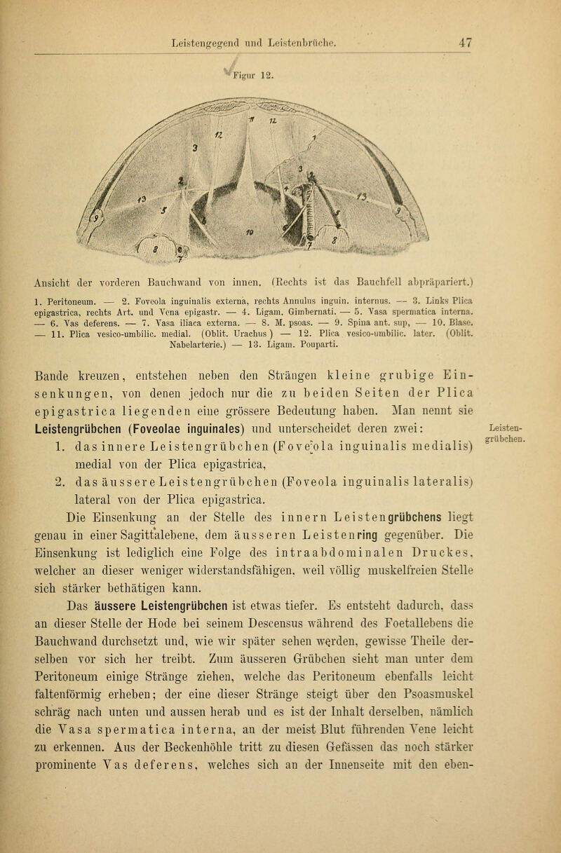 Figur 12. Ansicht der vorderen Bauchwcand von innen. (Rechts ist das Bauchfell abpräpariert,) 1. Peritoneum. — 2. Foveola inguinalis externa, rechts Annulus inguin. Internus. — 3. Links Plica epigastrica, rechts Art. und Vena epigastr. — 4. Ligam. Gimhernati. — 5. Vasa sperniatica interna. — 6. Yas deferens. — 7. Vasa iliaca externa. — 8. M. psoas. — 9. Spina ant. sup, — 10. Blase. — 11. Plica vesico-umbilic. medial. (Oblit. Urachus) — 12. Plica vesico-umbilic. later. (Oblit. Nabelarterie.) — 13. Ligam. Pouparti. Bande kreuzen, entstehen neben den Strängen kleine grub ige Ein- senkungen, von denen jedoch nur die zu beiden Seiten der Plica epigastrica liegenden eine grössere Bedeutung haben. Man nennt sie Leistengrübchen (Foveolae inguinales) und unterscheidet deren zwei: 1. das innere Leistengrübchen (Fove^ola inguinalis medialis) medial von der Plica epigastrica, 2. das äussere Leistengrübchen (Foveola inguinalis lateralis) lateral von der Plica epigastrica. Die Einsenkung an der Stelle des Innern Leistengriibchens liegt genau in einer Sagittalebene, dem äusseren Leisten ring gegenüber. Die Einsenkung ist lediglich eine Folge des intraabdominalen Druckes, welcher an dieser weniger widerstandsfähigen, weil völlig muskelfreien Stelle sich stärker bethätigen kann. Das äussere Leistengrlibchen ist etwas tiefer. Es entsteht dadurch, das.^ an dieser Stelle der Hode bei seinem Descensus während des Foetallebens die Bauchwand durchsetzt und, wie wir später sehen werden, gewisse Theile der- selben vor sich her treibt. Zum äusseren Grübchen sieht man unter dem Peritoneum einige Stränge ziehen, welche das Peritoneum ebenfalls leicht faltenförmig erheben; der eine dieser Stränge steigt tiber den Psoasmuskel schräg nach unten und aussen herab und es ist der Inhalt derselben, nämlich die Vasa spermatica interna, an der meist Blut führenden Yene leicht zu erkennen. Aus der Beckenhöhle tritt zu diesen Gefässen das noch stärker prominente Vas deferens, welches sich an der Innenseite mit den eben- Leisten- grü beben.