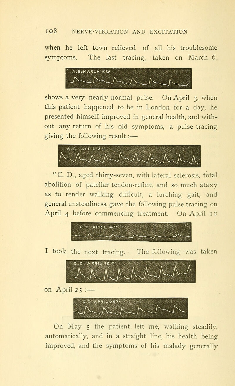 when he left town relieved of all his troublesome symptoms. The last tracing( taken on March 6, A.B.MARCH 6™ shows a very nearly normal pulse. On April 3, when this patient happened to be in London for a day, he presented himself, improved in general health, and with- out any return of his old symptoms, a pulse tracing giving the following result:— C. D., aged thirty-seven, with lateral sclerosis, total abolition of patellar tendon-reflex, and so much ataxy as to render walking difficult, a lurching gait, and general unsteadiness, gave the following pulse tracing on April 4 before commencing treatment. On April 12 I took the next tracing-- The following was taken G . D . APRIL 12™ on April 2 5 On May 5 the patient left me, walking steadily, automatically, and in a straight line, his health being improved, and the symptoms of his malady generally