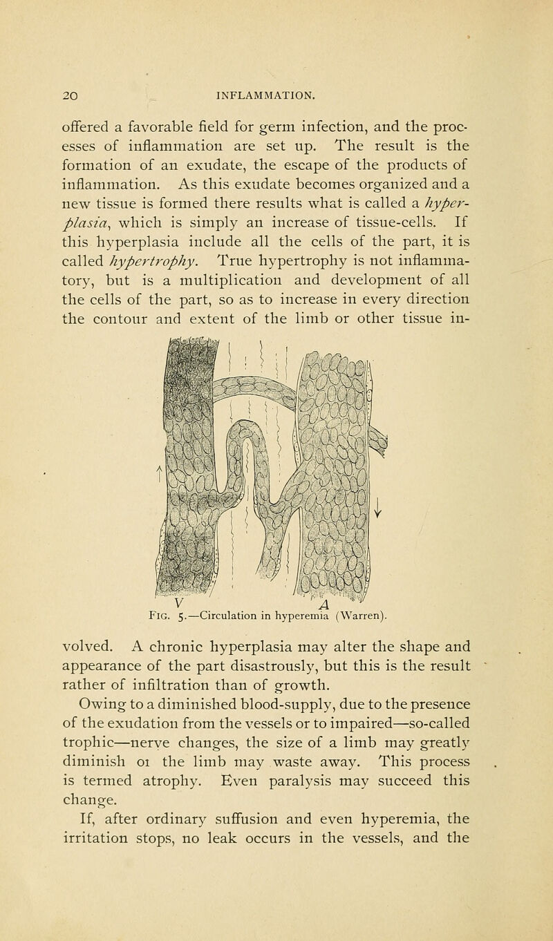 offered a favorable field for germ infection, and the proc- esses of inflammation are set up. The result is the formation of an exudate, the escape of the products of inflammation. As this exudate becomes organized and a new tissue is formed there results what is called a hyper- plasia^ which is simply an increase of tissue-cells. If this hyperplasia include all the cells of the part, it is called hypertrophy. True hypertrophy is not inflamma- tory, but is a multiplication and development of all the cells of the part, so as to increase in every direction the contour and extent of the limb or other tissue in- FlG 5 —Circulation in hyperemia (Warren). volved. A chronic hyperplasia may alter the shape and appearance of the part disastrously, but this is the result rather of infiltration than of growth. Owing to a diminished blood-supply, due to the presence of the exudation from the vessels or to impaired—so-called trophic—nerve changes, the size of a limb may greatly diminish oi the limb may waste away. This process is termed atrophy. Even paralysis may succeed this change. If, after ordinary suffusion and even hyperemia, the irritation stops, no leak occurs in the vessels, and the