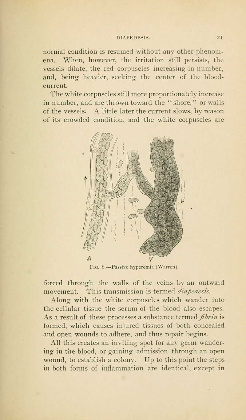 normal condition is resumed without any other phenom- ena. When, however, the irritation still persists, the vessels dilate, the red corpuscles increasing in number, and, being heavier, seeking the center of the blood- current. The white corpuscles still more proportionately increase in number, and are thrown toward the shore, or walls of the vessels. A little later the current slows, by reason of its crowded condition, and the white corpuscles are Fig. 6.—Passive hyperemia (Warren). forced through the walls of the veins by an outward movement. This transmission is termed diapedesis. Along with the white corpuscles which wander into the cellular tissue the serum of the blood also escapes. As a result of these processes a substance termed yfZrzVz is formed, which causes injured tissues of both concealed and open wounds to adhere, and thus repair begins. All this creates an inviting spot for any germ wander- ing in the blood, or gaining admission through an open wound, to establish a colony. Up to this point the steps in both forms of inflammation are identical, except in