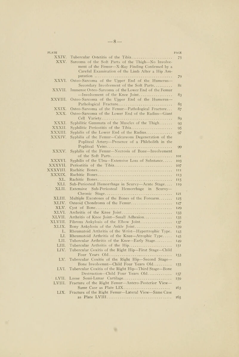 PLATE PAGE XXIV. Tubercular Ostetitis of the Tibia 75 XXV. Sarcoma of the Soft Parts of the Thigh—No Involve- ment of the Femur—X-Ray Finding Confirmed by a Careful Examination of the Limb .After a Hip .Am- putation -g XXVT. Osteo-Sarcoma of the Upper End of the Humerus—• Secondary Involvement of the Soft Parts 81 XXVII. Immense Osteo-Sarcoma of the Lower End of the Femur —Involvement of the Knee Joint 83 XXVIII. Osteo-Sarcoma of the L^pper End of the Humerus— Pathological Fracture 85 XXIX. Osteo-Sarcoma of the Femur—Pathological Fracture... 87 XXX. Osteo-Sarcoma of the Lower End of the Radius—Giant Cell Variety 89 XXXI. Syphilitic Gummata of the Muscles of the Thigh 93 XXXII. Syphilitic Periostitis of the Tibia 95 XXXIII. Syphilis of the Lower End of the Radius 97 XXXIV. Syphilis of the Femur—Calcareous Degeneration of the Popliteal Artery—Presence of a Phlebolith in the Popliteal Veins 99 XXXV. Syphilis of the Femur—Necrosis of Bone—Involvement of the Soft Parts loi XXXVI. Syphilis of the Ulna—Extensive Loss of Substance 103 XXXVII. Periostitis of the Tibia 107 XXXVIII. Rachitic Bones in XXXIX. Rachitic Bones 113 XL. Rachitic Bones 115 XLI. Sub-Periosteal Hetnorrhage in Scurvy—Acute Stage.... 119 XLII. Extensive Sub-Periosteal Hemorrhage in Scurvy— Chronic Stage 121 XLIII. Multiple Exostoses of the Bones of the Forearm 125 XLIV. Osteoid Chondroma of the Femur 127 XLV. Cyst of Bone 129 XLVI. Archritis of the Knee Joint 133 XLVII. Arthritis of Knee Joint—Small Adhesion 135 XLVIII. Fibrous Ankylosis of the Elbow Joint 137 XLIX. Bony Ankylosis of the Ankle Joint 139 L. Rheumatoid Arthritis of the Wrist—Hypertrophic Type. l-)3 LI. Rheumatoid Arthritis of the Knee—Atrophic Type I-)S LII. Tubercular Arthritis of the Knee—Early Stage 149 LIII. Tubercular .Arthritis of the Hip 151 LIV. Tubercular Coxitis of the Right Hip—First Stage—Child Four Years Old 153 LV. Tubercular Coxitis of the Right Hip—Second Stage— Bone Involvemnt—Child Four Years Old 155 LVI. Tubercular Coxitis of the Right Hip—Third Stage—Bone Destruction—Child Four Years Old 157 LVII. Loose Semi-Lunar Cartilage 159 LVIII. Fracture of the Right Femur—.Antero-Posterior View— Same Case as Plate LIX 163 LIX. Fracture of the Right Femur—Lateral View—Same Case as Plate LVIII 165
