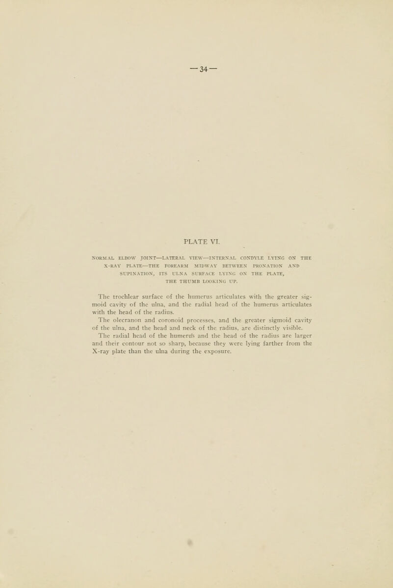 — 34- PLATE VI. NORMAL ELBOW JOINT—LATER.\L VIEW—IXTERXAL CO^•D^XE LYING ON THE X-RAY PLATE—THE FOREARM MIDWAY BETWEEX PRONATION AND SUPINATION, ITS ULNA SURFACE LYING ON THE PLATE, THE THUMB LOOKING UP. The trochlear surface of the humerus articulates with the greater sig- moid cavity of the ulna, and the radial head of the humerus articulates with the head of the radius. The olecranon and coronoid processes, and the greater sigmoid cavity of the ulna, and the head and neck of the radius, are distinctly visible. The radial head of the huraerrfs and the head of the radius are larger and their contour not so sharp, because they were lying farther from the X-ray plate than the ulna during the exposure.
