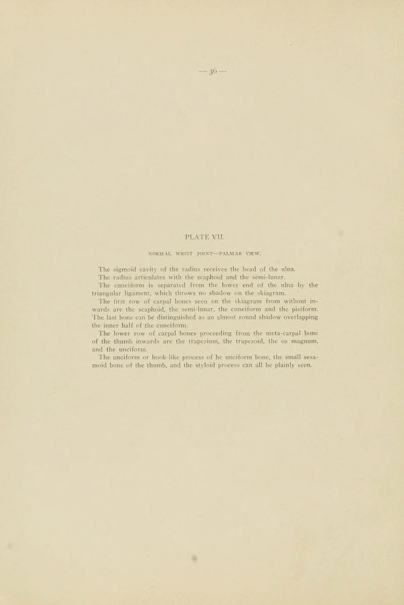 -36 PLATE VII. NORMAL WRIST JOIXT—PALMAR VIEW. The sigmoid cavity of the radius receives the head of the ulna. The radius articulates with the scaplioid and the semi-kui?r. The cuneiform is separated from tlie lower end of the uhia by tlie triangular ligament, which throws no shadow on the skiagrauL The first row of carpal bones seen on the skiagram from without in- wards are the scaphoid, the semi-lunar, the cuneiform and the pisiform. The last bone can be distinguished as an almost round shadow overlapping the inner half of the cuncifonn. The lower row of carpal bones proceeding from the nieta-cariKil bone of the thumb inwards are the trapezium, the trapezoid, the os m.^gnunl, and the unciform. The unciform or hook-like process of he unciform bono, tlie small sesa- moid bone of the thumb, and the styloid process can all be plainly seen.