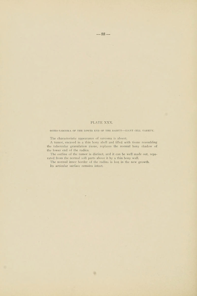 OSTEO-SAECOMA OF THE LOWER EXn OE THE RAPTl'S—CIAXT TELL VARIETY. The characteristic appearance of sarcoma is aljsent. A tumor, encased in a thin bony shell and filled with tissue resembling the tubercular granulation tissue, replaces the normal bony shadow of the lower end of the radius. The outline of the tumor is distinct, ar.d it can be well made out, sepa- rated from the normal soft parts above it by a thin bony wall. The normal inner border of the radius is lost in the new growth. Its articular surface remains intact.