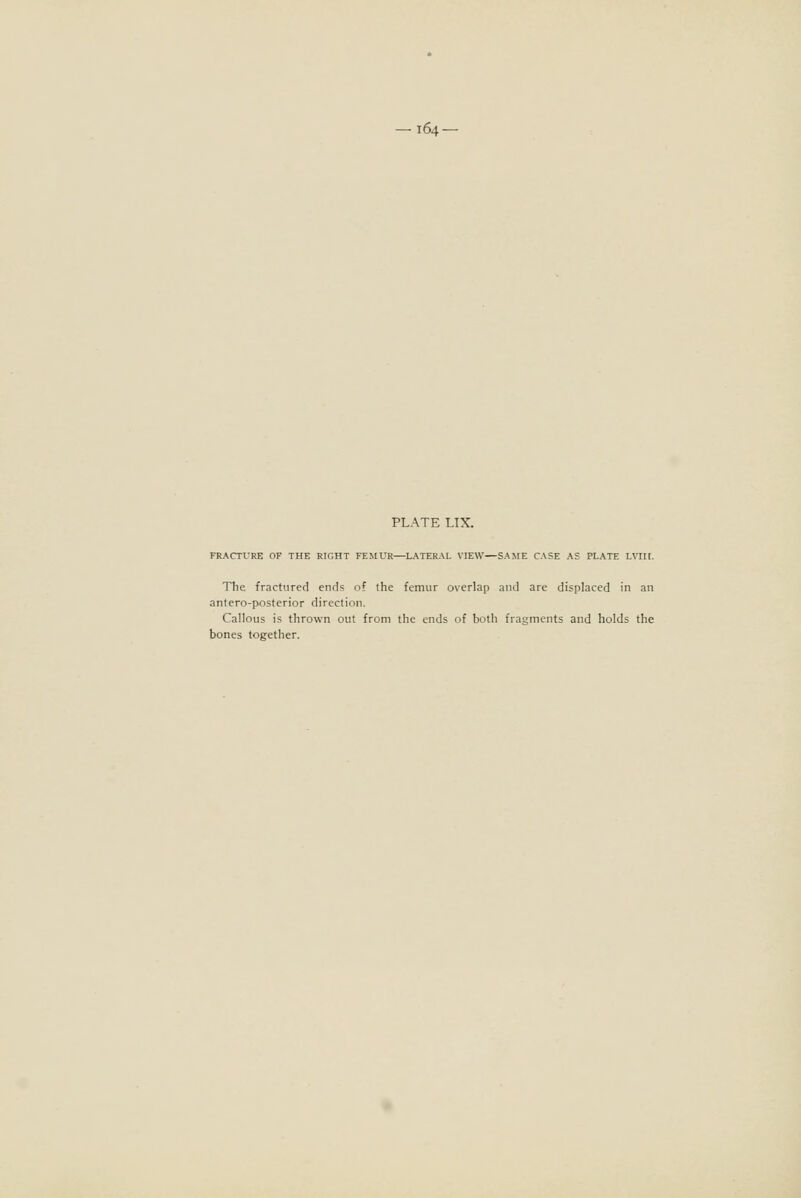 PLATE LIX. FRACTURE OF THE RIGHT FEMUR—LATERAL VIEW—SAME CASE AS PLATE LVIU. The fractured ends of the femur overlap and are displaced in an antero-posterior direction. Callous is thrown out from the ends of both fragments and holds the bones together.