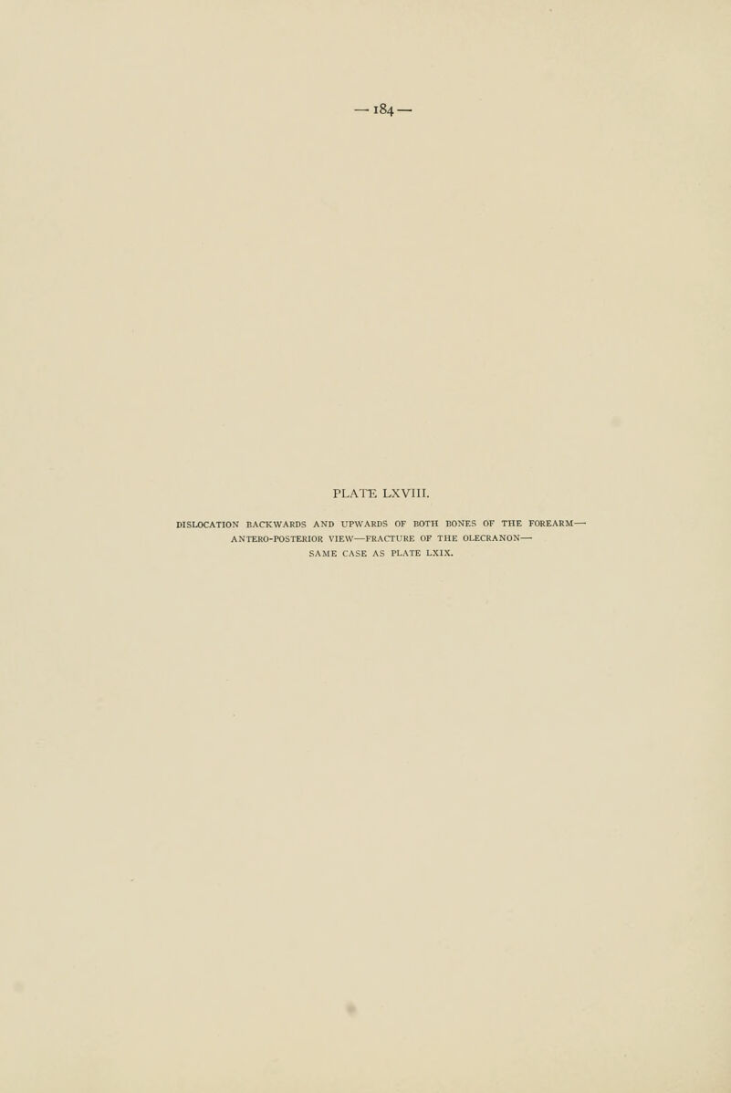 PLATE LXVIII. DISLOCATION BACKWARDS AND UPWARDS OF BOTH BONES OF THE FOREARM- ANTERO-POSTERIOR VIEW—FRACTURE OF THE OLECRANON— SAME CASE AS PLATE LXIX.