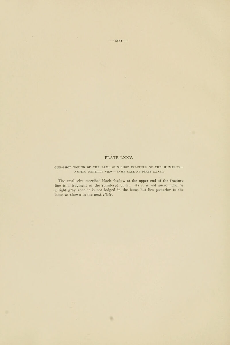 GUN-SHOT WOUND OF THE ARM—GUN-SHOT FRACTURE OF THE HUMERUS—■ ANTERO-POSTERIOR VIEW—SAME CASE AS PLATE LXXVI. The small circumscribed black shadow at the upper end of the fracture line is a fragment of the splintered bullet. As it is not surrounded by a light gray zone it is not lodged in the bone, but lies posterior to the bone, as shown in the next Plate.