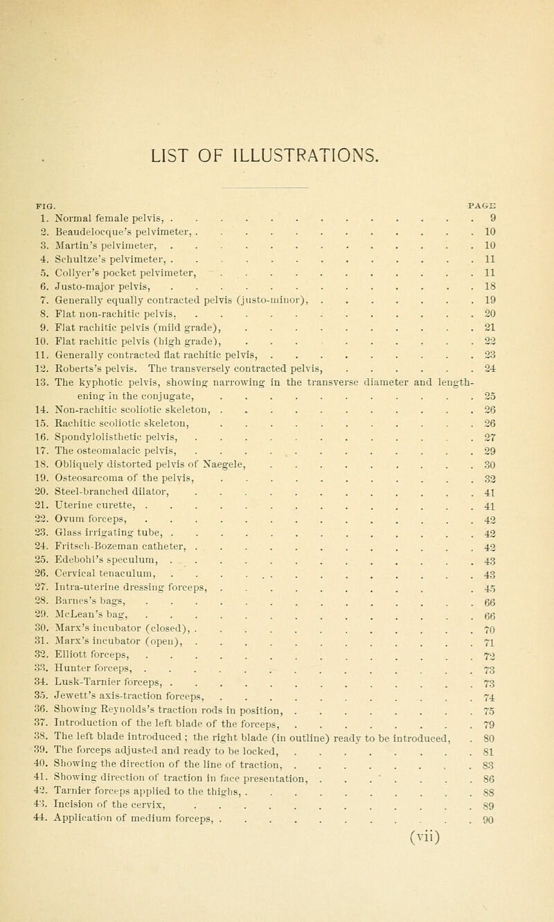 LIST OF ILLUSTRATIONS. FIG. PA&E 1. Normal female pelvis, 9 2. Beaudelocque's pelvimeter, 10 3. Martin's pelvimeter, ............. 10 4. Schultze's pelvimeter, .11 5. CoUyer's pocket pelvimeter, 11 6. Justo-major pelvis, 18 7. Generally equally contracted pelvis (justo-minor), 19 8. Flat non-rachitic pelvis, 20 9. Flat rachitic pelvis (mild grade), 21 10. Flat rachitic pelvis (high grade), 22 11. Generally contracted flat rachitic pelvis, 23 12. Roberts's pelvis. The transversely contracted pelvis, 24 13. The kyphotic pelvis, showing narrowing in the transverse diameter and length- ening in the conjugate, 25 14. Non-rachitic scoliotic skeleton, 26 15. Rachitic scoliotic skeleton, ........... 26 16. Spondylolisthetic pelvis, 27 17. The osteomalacic pelvis, 29 18. Obliquely distorted pelvis of Naegele, 80 19. Osteosarcoma of the pelvis, 32 20. Steel-branched dilator, 41 21. Uterine curette, 41 22. Ovum forceps, 42 23. Glass irilgating tube, 42 24. Fi-itsch-Bozeman catheter, ............ 42 25. Edebohl's speculum, 43 26. Cervical tenaculum, . . . . 43 27. Intra-uterine dressing forceps, .45 28. Barnes's bags, •■•........... 66 29. McLean's bag, .............. 66 30. Marx's incubator (closed), 70 31. Marx's incubator (open), 71 32. Elliott forceps, 72 3.S. Hunter forceps, 73 34. Lusk-Tarnier forceps, 73 35. Jewett's axis-traction forceps, ........... 74 36. Showing Reynolds's traction rods in position, 75 37. Introduction of the left blade of the forceps, 79 38. The left blade introduced ; the right blade (in outline) ready to be introduced, . 80 39. The forceps adjusted and ready to be locked, 81 40. Showing the direction of the line of traction, . 83 41. Showing direction of traction in face presentation, . . . ' . . . .86 42. Tarnier forceps applied to the thighs, 88 43. Incision of the cervix, ............ 89 44. Application of medium forceps, 90