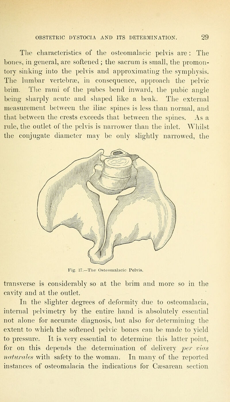 The characteristics of the osteomalacic pelvis are : The bones, in general, are softened; the sacrum is small, the promon- tory sinking- into the pelvis and approximating the symphysis. The lumbar vertebrae, in consequence, approach the pelvic brim. The rami of the pubes bend inward, the pubic angle being sharply acute and shaped like a beak. The external measurement between the iliac spines is less than normal, and that between the crests exceeds that between the spines. As a rule, the outlet of the pelvis is narrower than the inlet. AVhilst the conjugate diameter may be only slightly narrowed, the Fig. 17.—The Osteomalacic Pelvis. transverse is considerably so at the brim and more so in the cavity and at the outlet. In the slighter degrees of deformity due to osteomalacia, internal pelvimetry by the entire hand is absolutely essential not alone for accurate diagnosis, but also for determining the extent to which the softened pelvic bones can be made to yield to pressure. It is very essential to determine this latter point, for on this depends the determination of delivery i^er vias naturaJes with safety to the woman. In many of the reported instances of osteomalacia the indications for Ceesarean section