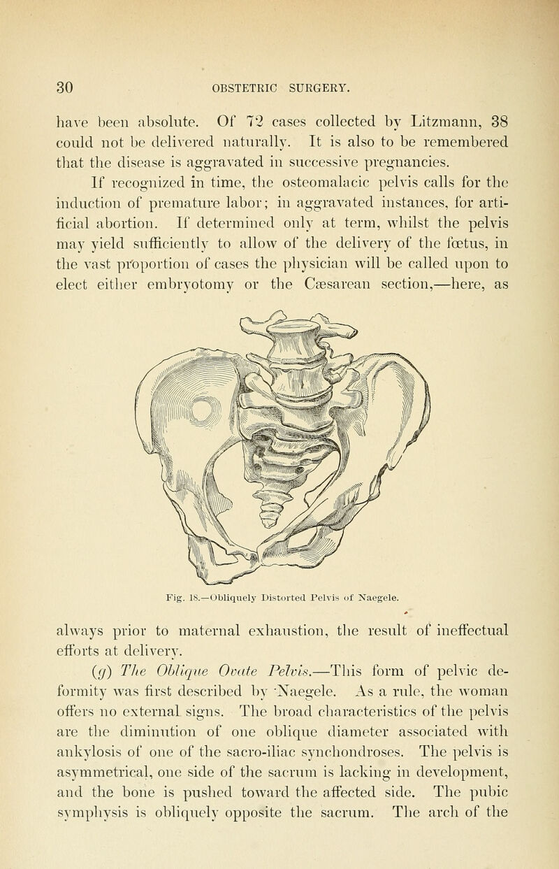 have been absolute. Of 72 cases collected by Litzmann, 38 could not be delivered naturally. It is also to be remembered that the disease is aggravated in successive pregnancies. If recognized in time, the osteomalacic pelvis calls for the induction of premature labor; in aggravated instances, for arti- ficial abortion. If determined only at term, whilst the pelvis may yield sufiiciently to allow of the delivery of the foetus, in the vast proportion of cases the physician will be called upon to elect either embryotomy or the Csesarean section,—here, as Fig. 18.—Obliquely Distorted Pelvis of Naegele. always prior to maternal exhaustion, the result of ineffectual efforts at delivery. (g) The Oblique Ovate Pelvis.—This form of pelvic de- formity was first described by 'Naegele. As a rule, the woman offers no external signs. The broad characteristics of the pelvis are the diminution of one oblique diameter associated with ankylosis of one of the sacro-iliac synchondroses. The pelvis is asymmetrical, one side of the sacrum is lacking in development, and the bone is pushed toward the affected side. The pubic symphysis is obliquely opposite the sacrum. The arch of the