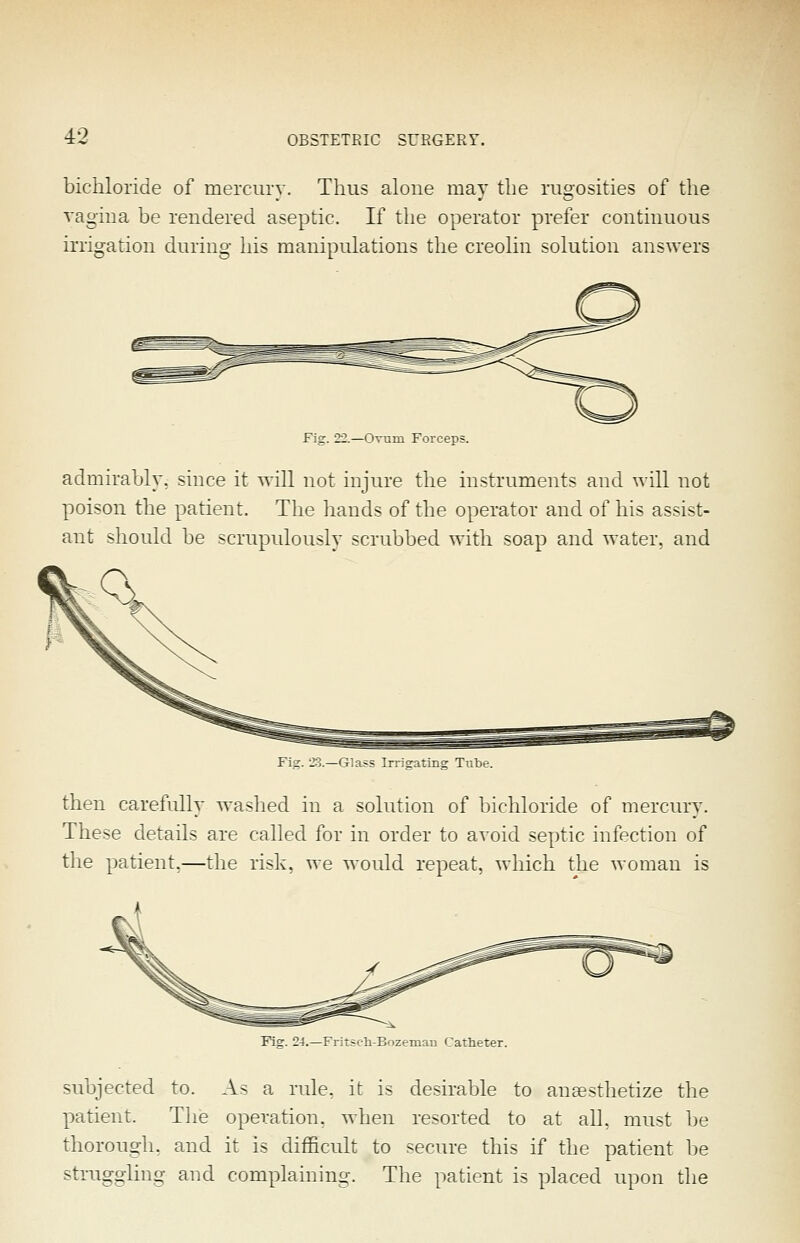 bichloride of mercury. Thus alone may the rugosities of the vagiua be rendered aseptic. If the operator prefer continuous irrigation during Ins manipulations tlie creolin solution answers Fig. 22.—OTTim Forceps. admirably, since it will not injure the instruments and will not poison the patient. The liands of the operator and of his assist- ant should be scrupulously scrubbed with soap and Avater, and Fig. 23.—Glass Irrigating Tube. then carefully washed in a solution of bichloride of mercury. These details are called ibr in order to avoid septic infection of the patient.—the risk, we would repeat, which the woman is Fig. 24.—Fritsch-Bozemau Catheter. subjected to. As a rule, it is desirable to anaesthetize the patient. The operation, when resorted to at alh must he thorough, and it is difficult to secure this if the patient be struggling and complaining. The patient is placed upon the