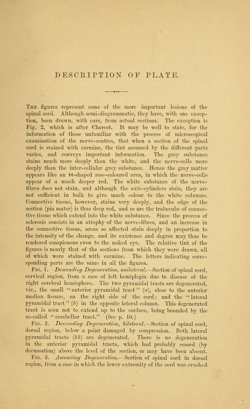 DESCRIPTION OF PLATE. The figures represent some of the more important lesions of the spinal cord. Although semi-diagrammatic, they have, with one excep- tion, been drawn, with care, from actual sections. The exception is Fig. 2, which is after Charcot. It may be well to state, for the information of those unfamiliar with the process of microscopical examination of the nerve-centres, that when a section of the spinal cord is stained with carmine, the tint assumed by the different parts varies, and conveys important information. The grey substance stains much more deeply than the white, and the nerve-cells more deeply than the inter-cellular grey substance. Hence the grey matter appears like an H-shaped rose-coloured area, in which the nerve-cells appear of a much deeper red. The white substance of the nerve- fibres does not stain, and although the axis-cylinders stain, they are not sufficient in bulk to give much colour to the white columns. Connective tissue, however, stains very deeply, and the edge of the section (pia mater) is thus deep red, and so are the trabecule of connec- tive tissue which extend into the white substance. Since the process of sclerosis consists in an atrophy of the nerve-fibres, and an increase in the connective tissue, areas so affected stain deeply in proportion to the intensity of the change, and its existence and degree may thus be rendered conspicuous even to the naked eye. The relative tint of the figures is nearly that of the sections from which they were drawn, all of which were stained with carmine. The letters indicating corre- sponding parts are the same in all the figures. Fig. 1. Descending Degeneration, unilateral.—Section of spinal cord, cervical region, from a case of left hemiplegia due to disease of the right cerebral hemisphere. The two pyramidal tracts are degenerated, viz., the small anterior pyramidal tract (a), close to the anterior median fissure, on the right side of the cord; and the lateral pyramidal tract (b) in the opposite lateral column. This degenerated tract is seen not to extend up to the surface, being bounded by the so-called cerebellar tract. (See p. 10.) Fig. 2. Descending Degeneration, bilateral.—Section of spinal cord, dorsal region, below a point damaged by compression. Both, lateral pyramidal tracts (bb) are degenerated. There is no degeneration in the anterior pyramidal tracts, which had probably ceased (by decussation) above the level of the section, or may have been absent. Fig. 3. Ascending Degeneration.—Section of spinal cord in dorsal region, from a case in which the lower extremitv of the cord was crushed