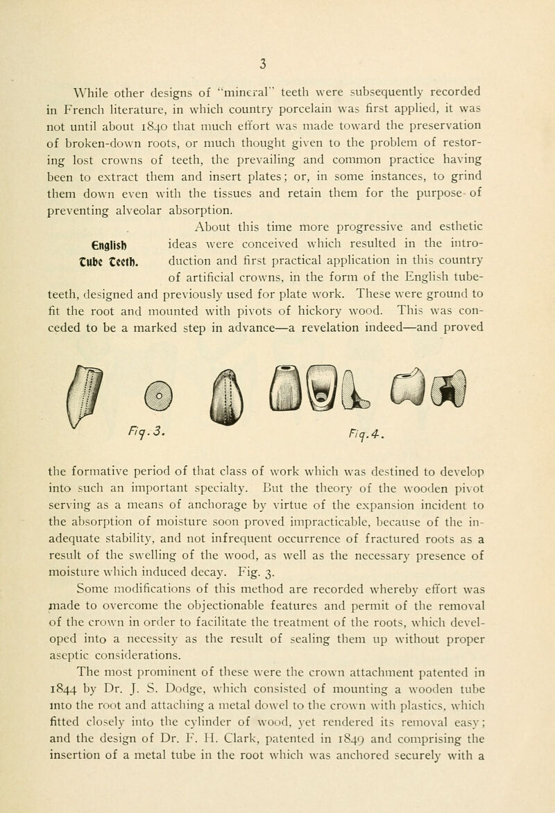 While other designs of mineral teeth were subsequently recorded in French literature, in which country porcelain was first applied, it was not until about 1840 that much effort was made toward the preservation of broken-down roots, or much thought given to the problem of restor- ing lost crowns of teeth, the prevailing and common practice having been to extract them and insert plates; or, in some instances, to grind them down even with the tissues and retain them for the purpose of preventing alveolar absorption. About this time more progressive and esthetic 6n9li$b ideas were conceived which resulted in the intro- tUbC Ccetb. duction and first practical application in this country of artificial crowns, in the form of the English tube- teeth, designed and previously used for plate work. These were ground to fit the root and mounted with pivots of hickory wood. This was con- ceded to be a marked step in advance—a revelation indeed—and proved Fiq.3. ricf.4. the formative period of that class of work which was destined to develop into such an important specialty. But the theory of the wooden pivot serving as a means of anchorage by virtue of the expansion incident to the absorption of moisture soon proved impracticable, because of the in- adequate stability, and not infrequent occurrence of fractured roots as a result of the swelling of the wood, as well as the necessary presence of moisture which induced decay. Fig. 3. Some modifications of this method are recorded whereby eiTort was jnade to overcome the objectionable features and permit of the removal of the crown in order to facilitate the treatment of the roots, which devel- oped into a necessity as the result of sealing them up without proper aseptic considerations. The most prominent of these were the crown attachment patented in 1844 by Dr. J. S. Dodge, which consisted of mounting a wooden tube mto the root and attaching a metal dowel to the crown with plastics, which fitted closely into the cylinder of wood, yet rendered its removal easy; and the design of Dr. F. H. Clark, patented in 1849 and comprising the insertion of a metal tube in the root which was anchored securely with a