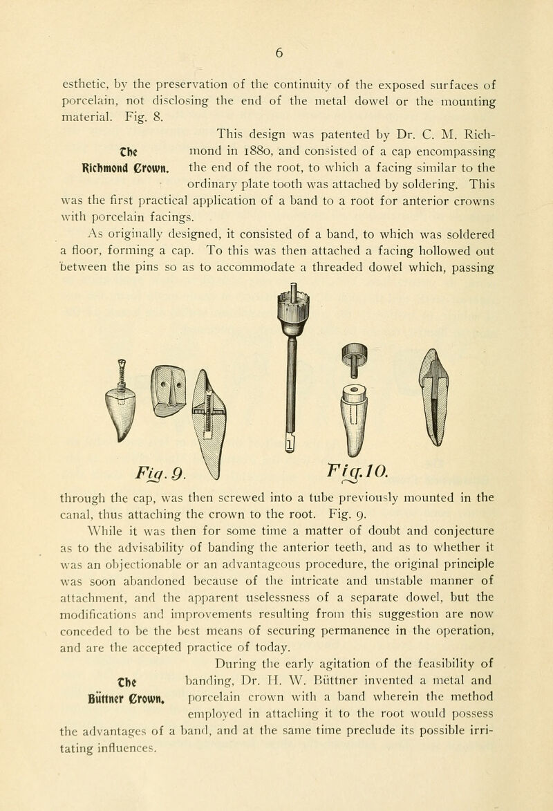 esthetic, by the preservation of the continviity of the exposed surfaces of porcelain, not disclosing the end of the metal dowel or the mounting material. Fig. 8. This design was patented by Dr. C. M. Rich- tbe mond in 1880, and consisted of a cap encompassing Richmond Crown. the end of the root, to which a facing similar to the ordinary plate tooth was attached by soldering. This was the first practical application of a band to a root for anterior crowns with porcelain facings. As originally designed, it consisted of a band, to which was soldered a floor, forming a cap. To this was then attached a facing hollowed out between the pins so as to accommodate a threaded dowel which, passing Fij/.Q P 1^.10. through the cap, was then screwed into a tube previously mounted in the canal, thus attaching the crown to the root. Fig. 9. While it was then for some time a matter of doubt and conjecture as to the advisability of banding the anterior teeth, and as to whether it was an objectionable or an advantageous procedure, the original principle was soon abandoned because of the intricate and unstable manner of attachment, and the apparent uselessness of a separate dowel, but the modifications and improvements resulting from this suggestion are now conceded to be the best means of securing permanence in the operation, and are the accepted practice of today. During the early agitation of the feasibility of Z\)t banding. Dr. IT. W. Riittner invented a metal and Blittner Crown, i)orcelain crown with a band wherein the method employed in attaching it to the root would possess the advantages of a band, and at the same time preclude its possible irri- tating influences.