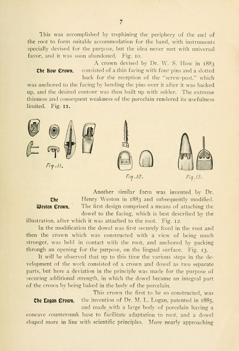 This was accomplished by trephining the periphery of the end of the root to form suitable accommodation for the band, with instruments specially devised for the purpose, but the idea never met with universal favor, and it was soon abandoned. Fig. lo. A crown devised by Dr. W. S. How in 1883 the Bow Crown. consisted of a thin facing with four pins and a slotted back for the reception of the screw-post, which was anchored to the facing by bending the pins over it after it was backed up, and the desired contour was then built up with solder. The extreme thinness and consequent weakness of the porcelain rendered its usefulness limited. Fig. 11. f'q .11. Fiq.12. Fiq.13. Another similar form was invented by Dr. tbC Henry Weston in 1883 and subsequently modified. (Ueston Crown. The first design comprised a means of attaching the dowel to the facing, which is best described by the illustration, after which it was attached to the root. Fig. 12. In the modification the dowel was first securely fixed in the root and then the crown which was constructed with a view of being much stronger, was held in contact with the root, and anchored by packing through an opening for the purpose, on the lingual surface. Fig. 13. It will be observed that up to this time the various steps in the de- velopment of the work consisted of a crown and dowel as two separate parts, but here a deviation in the principle was made for the purpose of securing additional strength, in which the dowel became an integral part of the crown by being baked in the body of the porcelain. This crown the first to be so constructed, was CbC Cogan Crown, tlie invention of Dr. M. L. Logan, patented in 1885. and made with a large body of porcelain having a concave countersunk base to facilitate adaptation to root, and a dowel shaped more in line with scientific principles. ]\Iore nearly approaching