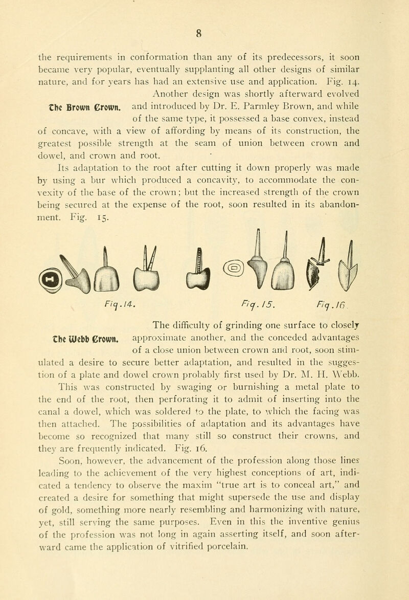 the requirements in conformation than any of its predecessors, it soon became very popular, eventually supplanting all other designs of similar nature, and for years has had an extensive use and application. Fig. 14. Another design was shortly afterward evolved CbC Brown Crown, and introduced by Dr. E. Parmley Brown, and while of the same type, it possessed a base convex, instead of concave, with a view of affording by means of its construction, the greatest possible strength at the seam of union between crown and dowel, and crown and root. Its adaptation to the root after cutting it down properly was made by using a bur which produced a concavity, to accommodate the con- vexity of the base of the crown; but the increased strength of the crown being secured at the expense of the root, soon resulted in its abandon- ment. Fig. 15. Fiq.l4. Fi cf.l5. Fiq. 16 The difficulty of grinding one surface to closely CbC UlCbb Crown. approximate another, and the conceded advantages of a close union between crown and root, soon stim- ulated a desire to secure better adaptation, and resulted in the sugges- tion of a plate and dowel crown probably first used by Dr. M. H. Webb. This was constructed by swaging or burnishing a metal plate to the end of the root, then perforating it to admit of inserting into the canal a dowel, which was soldered to the plate, to >,vhich the facing was then attached. The possibilities of adaptation and its advantages have become so recognized that many still so construct their crowns, and they are frequently indicated. Fig. 16. Soon, however, the advancement of the profession along those linesr leading to the achievement of the very highest conceptions of art, indi- cated a tendency to observe the maxim true art is to conceal art, and created a desire for something that might supersede the use and display of gold, something more nearly resembling and harmonizing with nature, yet, still serving the same purposes. Even in this the inventive genius of the profession was not long in again asserting itself, and soon after- ward came the application of vitrified porcelain.