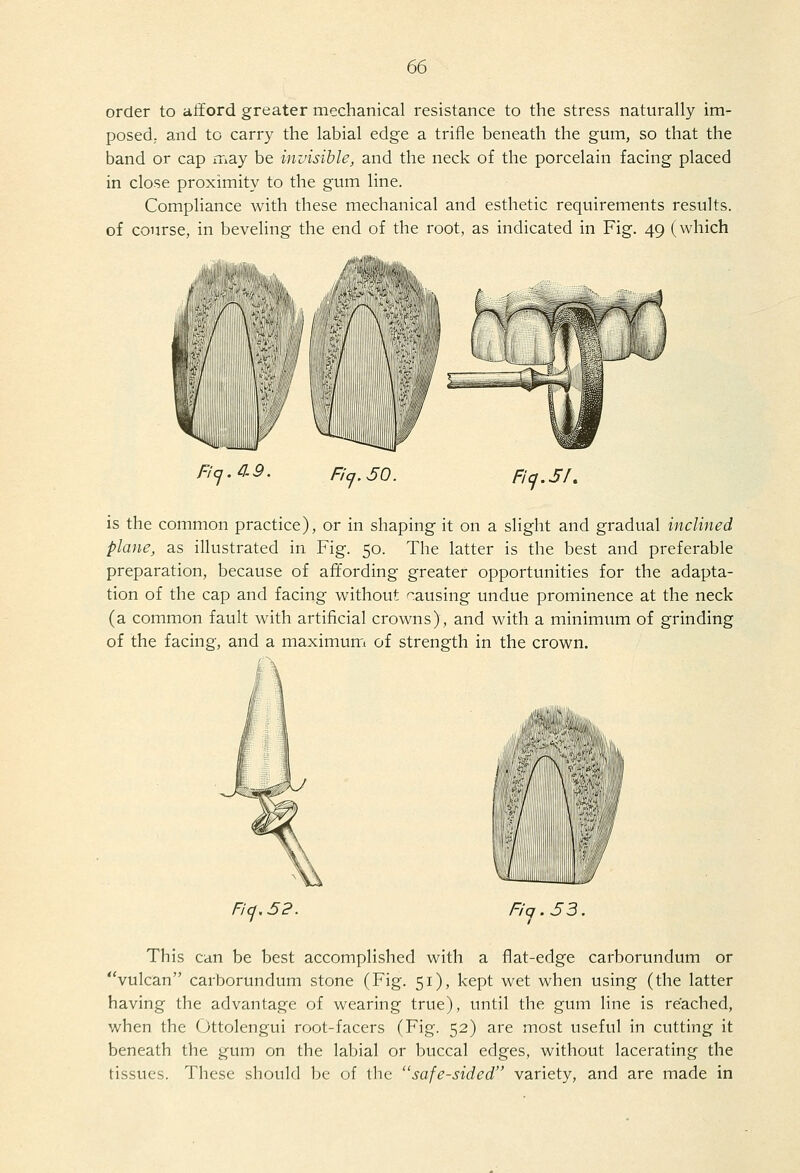 order to afford greater mechanical resistance to the stress naturally im- posed,, and to carry the labial edge a trifle beneath the gum, so that the band or cap may be invisible, and the neck of the porcelain facing placed in close proximity to the gum line. Compliance with these mechanical and esthetic requirements results, of course, in beveling the end of the root, as indicated in Fig. 49 (which 111--/ \ Fic^.^-9. Fia.50. Ficj.5/, is the common practice), or in shaping it on a slight and gradual inclined plane, as illustrated in Fig. 50. The latter is the best and preferable preparation, because of affording greater opportunities for the adapta- tion of the cap and facing without causing undue prominence at the neck (a common fault with artificial crowns), and with a minimum of grinding of the facing, and a maximum of strength in the crown. Ficj.5P. Fiq.53. This can be best accomplished with a flat-edge carborundum or vulcan carborundum stone (Fig. 51), kept wet when using (the latter having the advantage of wearing true), until the gum line is reached, when the (Jttolengui root-facers (Fig. 52) are most useful in cutting it beneath the gum on the labial or buccal edges, without lacerating the tissues. These should be of the safe-sided variety, and are made in