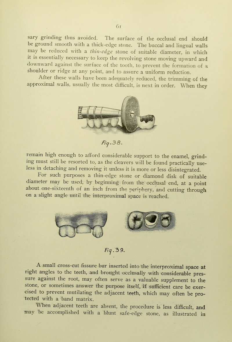 sary grinding thus avoided. The surface of the occlusal end should be ground smooth with a thick-edge stone. The buccal and lingual walls may be reduced with a thin-edge stone of suitable diameter, in which it is essentially necessary to keep the revolving stone moving upward and downward against the surface of the tooth, to prevent the formation of a shoulder or ridge at any point, and to assure a uniform reduction. After these walls have been adequately reduced, the trimming of the approximal walls, usually the most difficult, is next in order. When they Ficj.3 8. remain high enough to afford considerable support to the enamel, grind- ing must still be resorted to, as the cleavers will be found practically use- less in detaching and removing it unless it is more or less disintegrated. For such purposes a thin-edge stone or diamond disk of suitable diameter may be used, by beginning. from the occlusal end, at a point about one-sixteenth of an inch from the periphery, and cutting through on a slight angle until the interproximal space is reached. f/a.3 9. A small cross-cut fissure bur inserted into the interproximal space at right angles to the teeth, and brought occlusally with considerable pres- sure against the root, may often serve as a valuable supplement to the stone, or sometimes answer the purpose itself, if sufficient care be exer- cised to prevent mutilating the adjacent teeth, which may often be pro- tected with a band matrix. When adjacent teeth are absent, the procedure is less difficult, and may be accomplished with a blunt safe-edge stone, as illustrated in